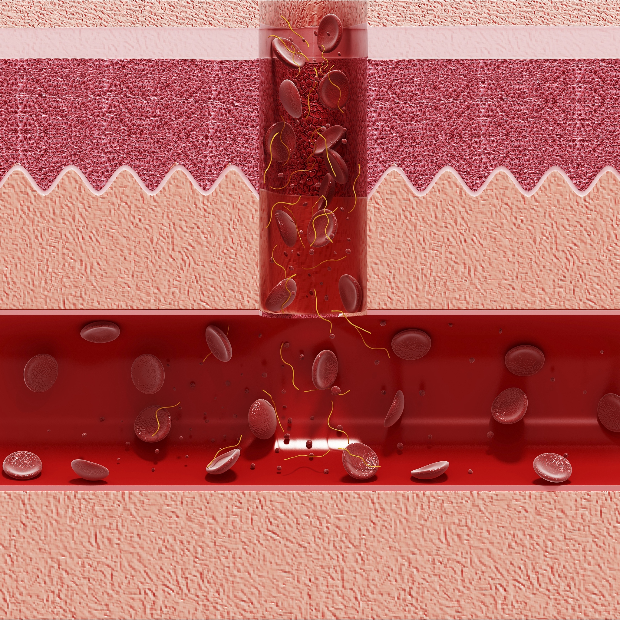 内皮细胞在纤维化皮肤病中有什么作用