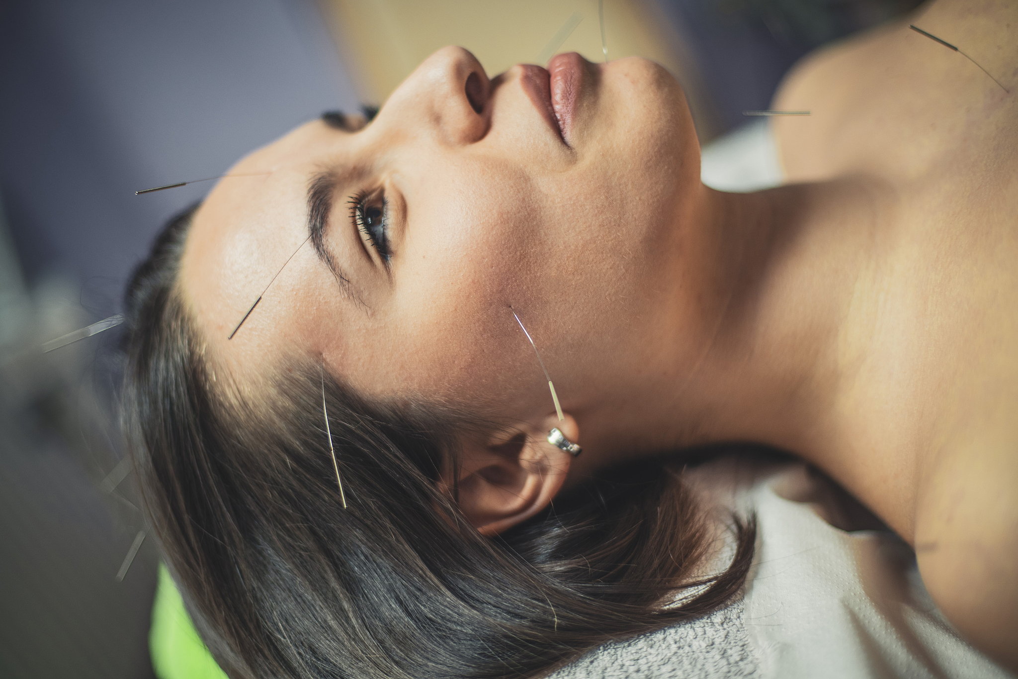 needles of relief