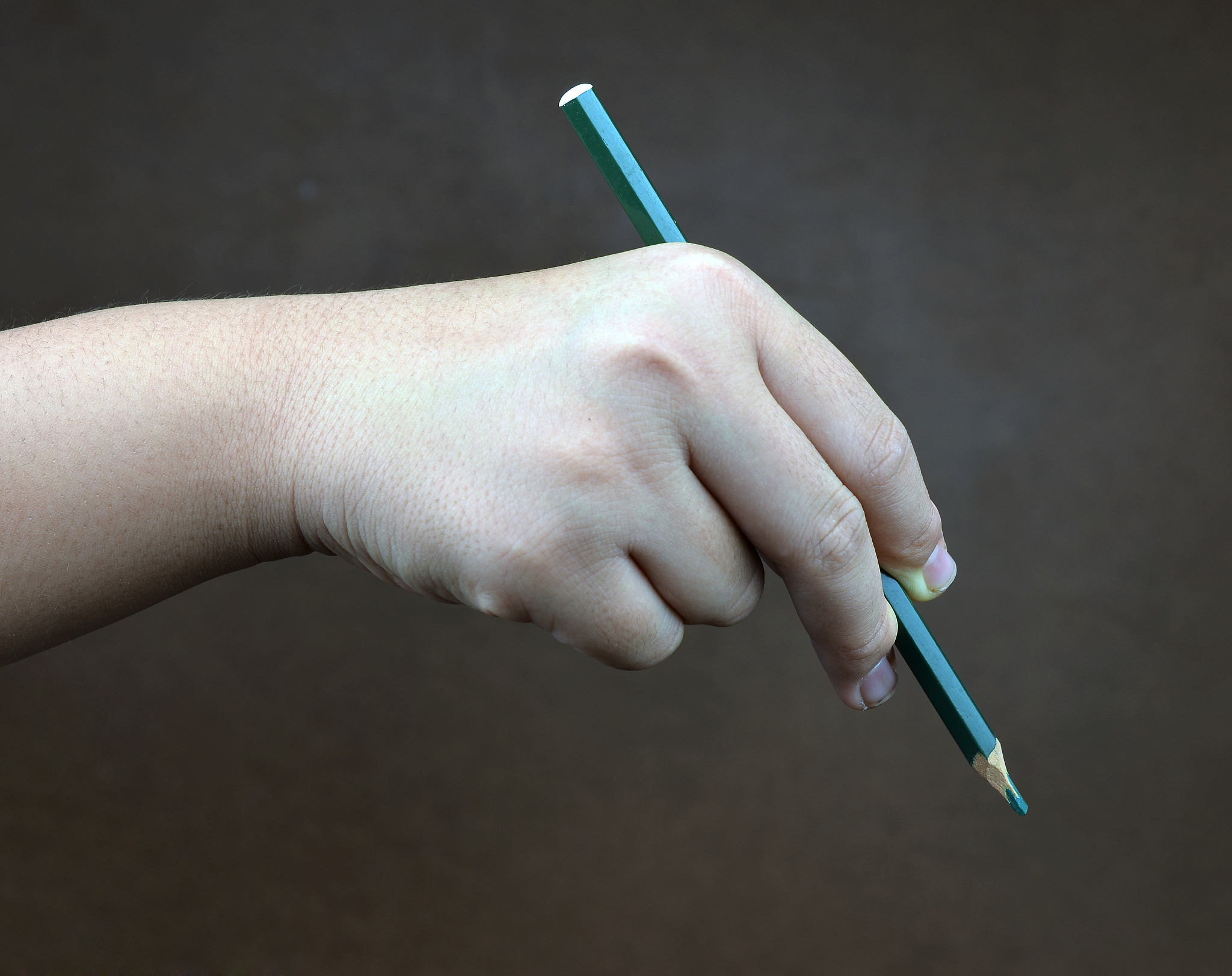 注射笔鼓包怎么办？附原因分析及预防措施