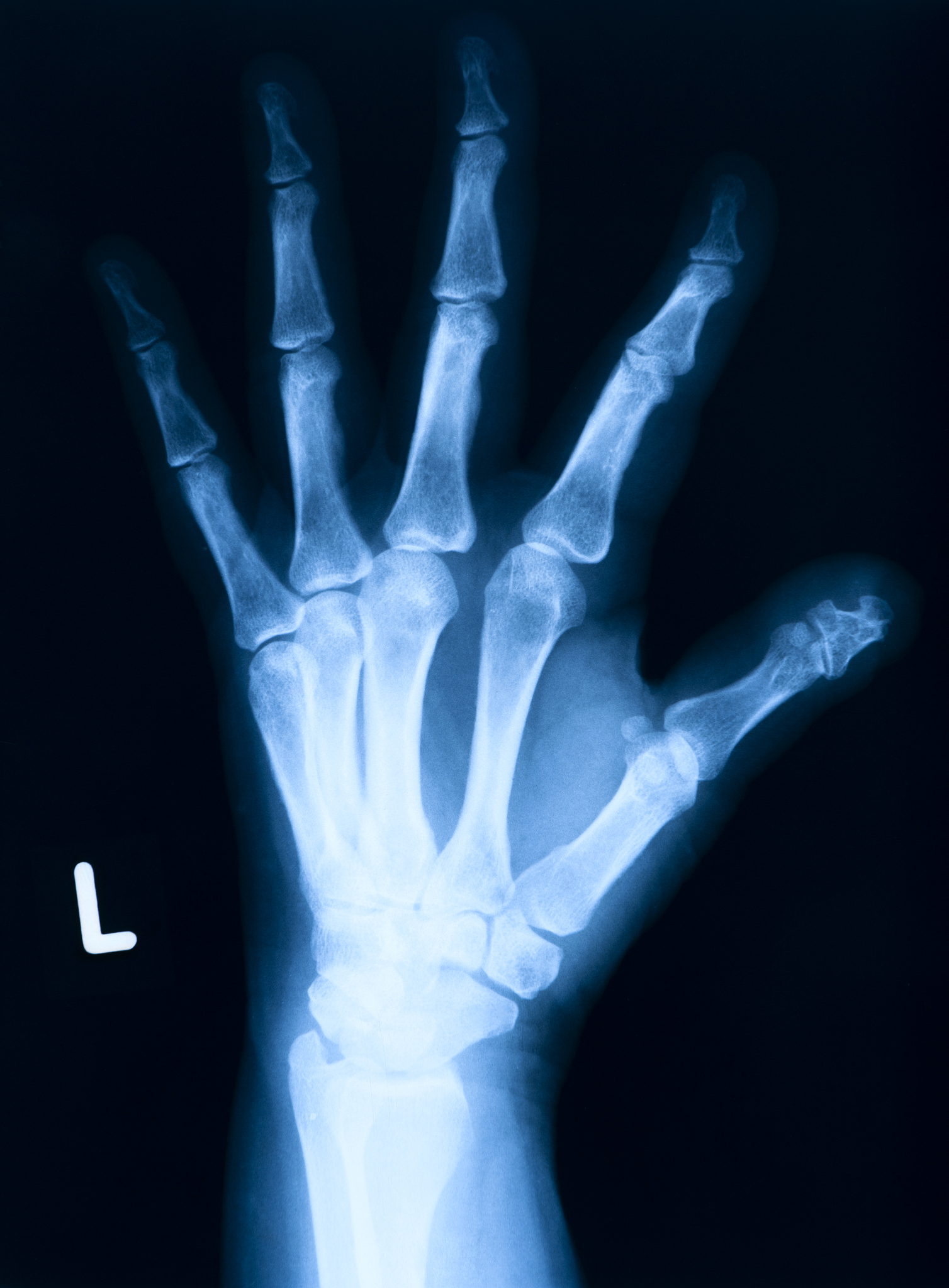 3	边缘检测：使用边缘检测算法如Canny算法、Sobel算法等检测图像中的边缘信息以便更好地分割手势。