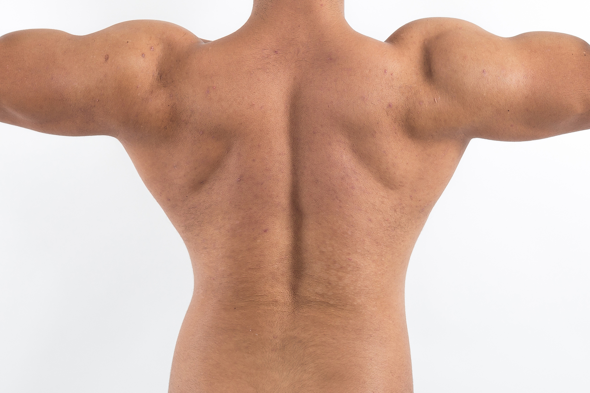 blemishes on muscle skin