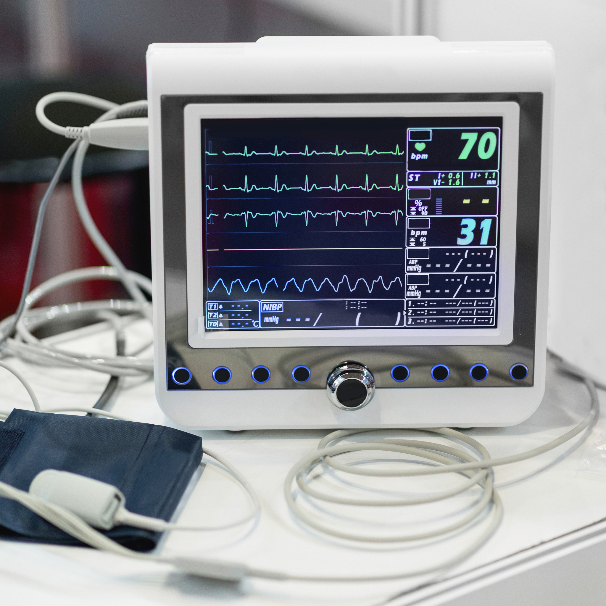 手术生命体征监测：保障手术安全的重要环节