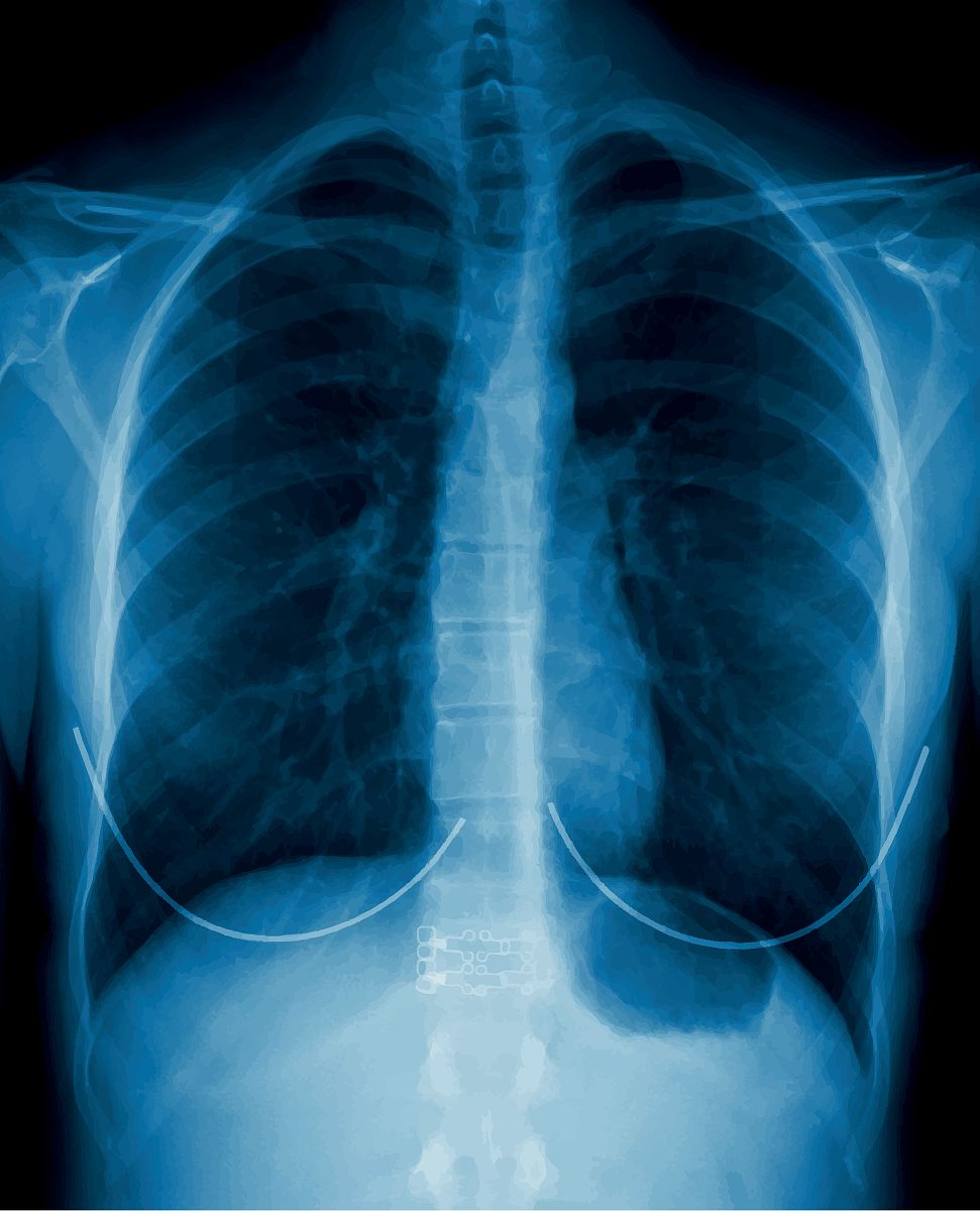 土壤污染状况调查的目的