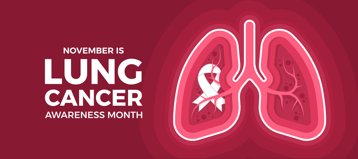 LUNG CANCER期刊推荐理由中文？