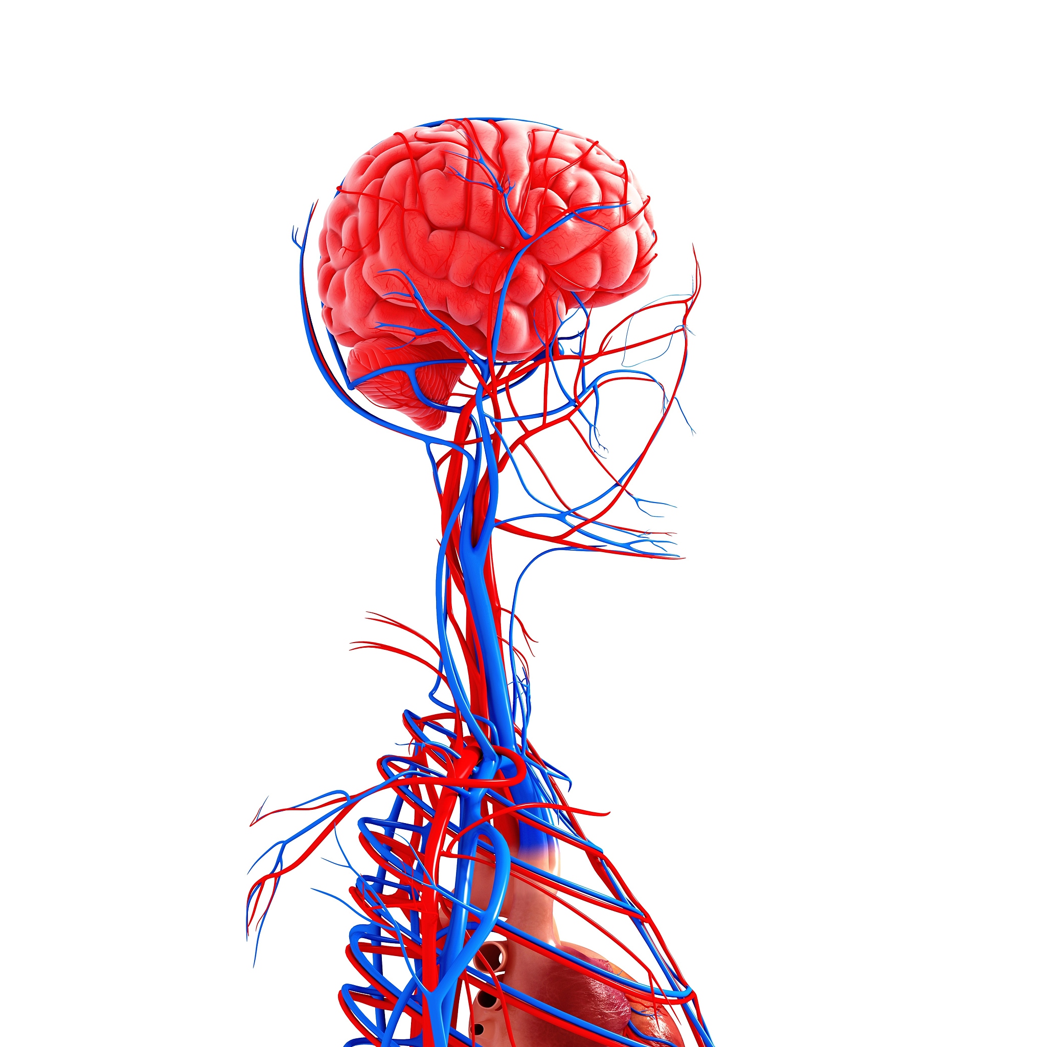 颈动脉斑块破裂导致的漂浮血栓：未被发现的风险