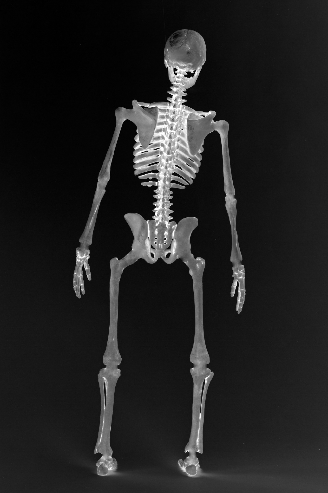 单人骨骼关键点识别算法：优缺点对比及应用场景