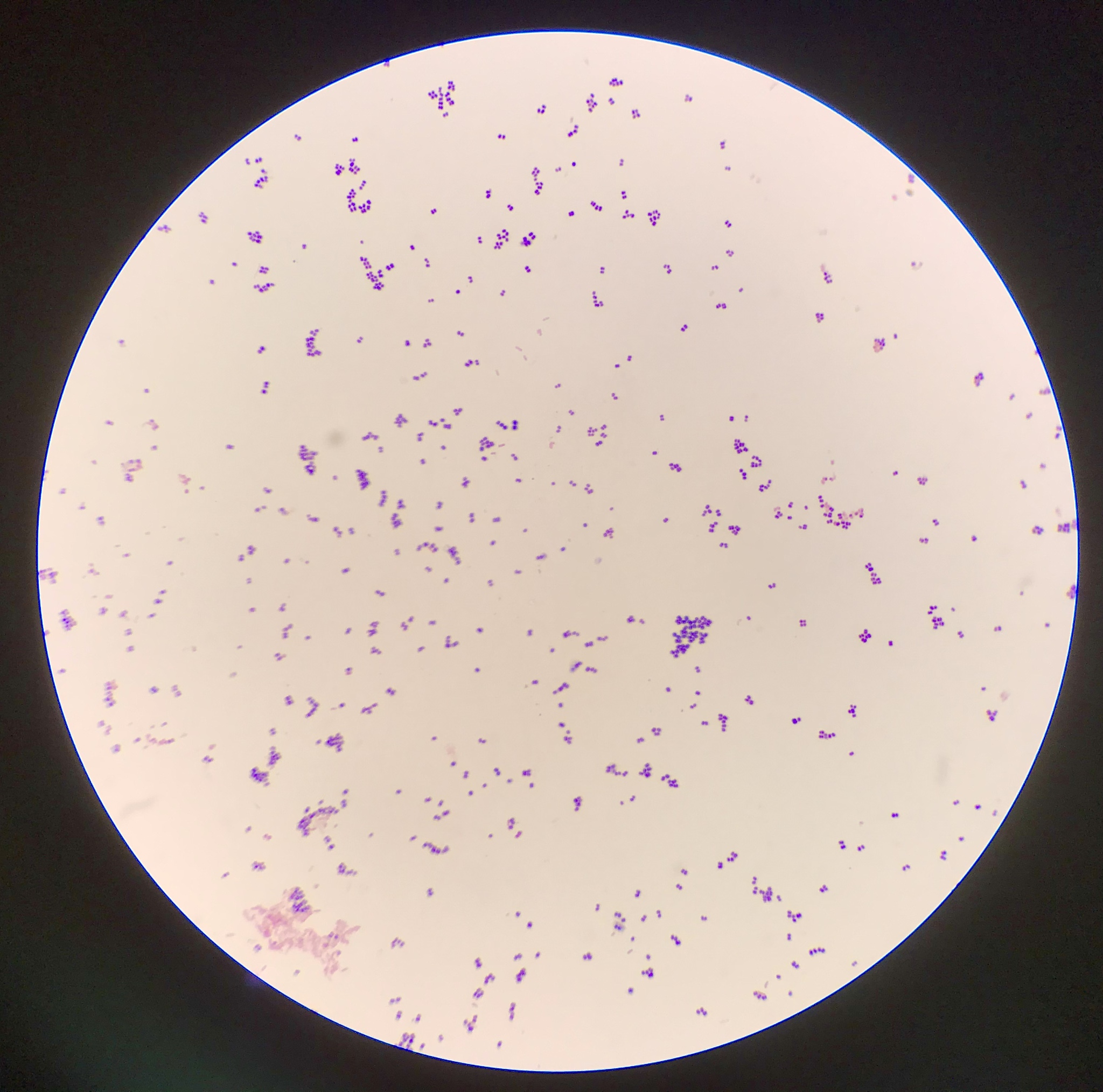 对未知菌进行革兰氏染色时如何保证操作正确与结果可靠