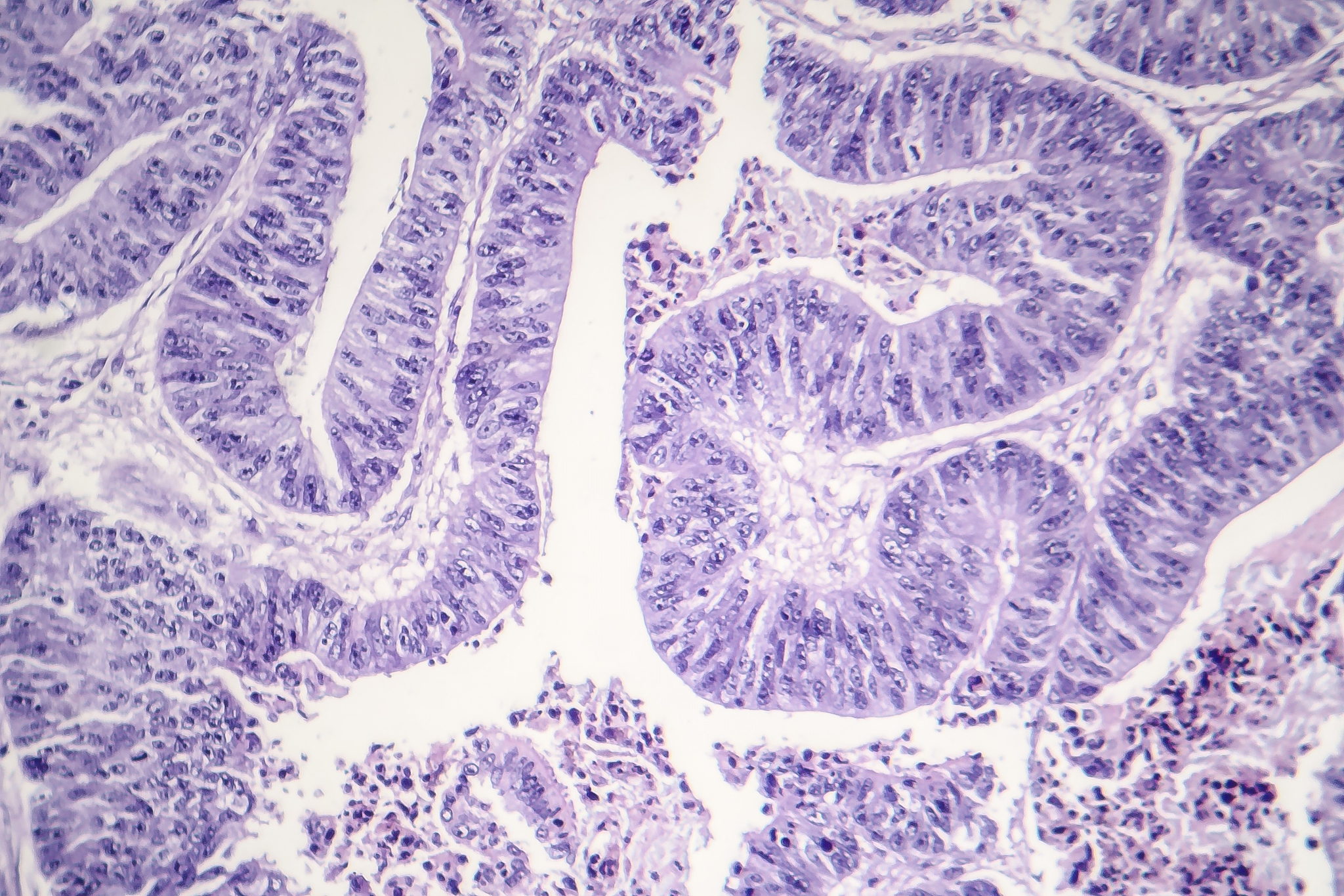 纤维灶和增殖灶的区别？