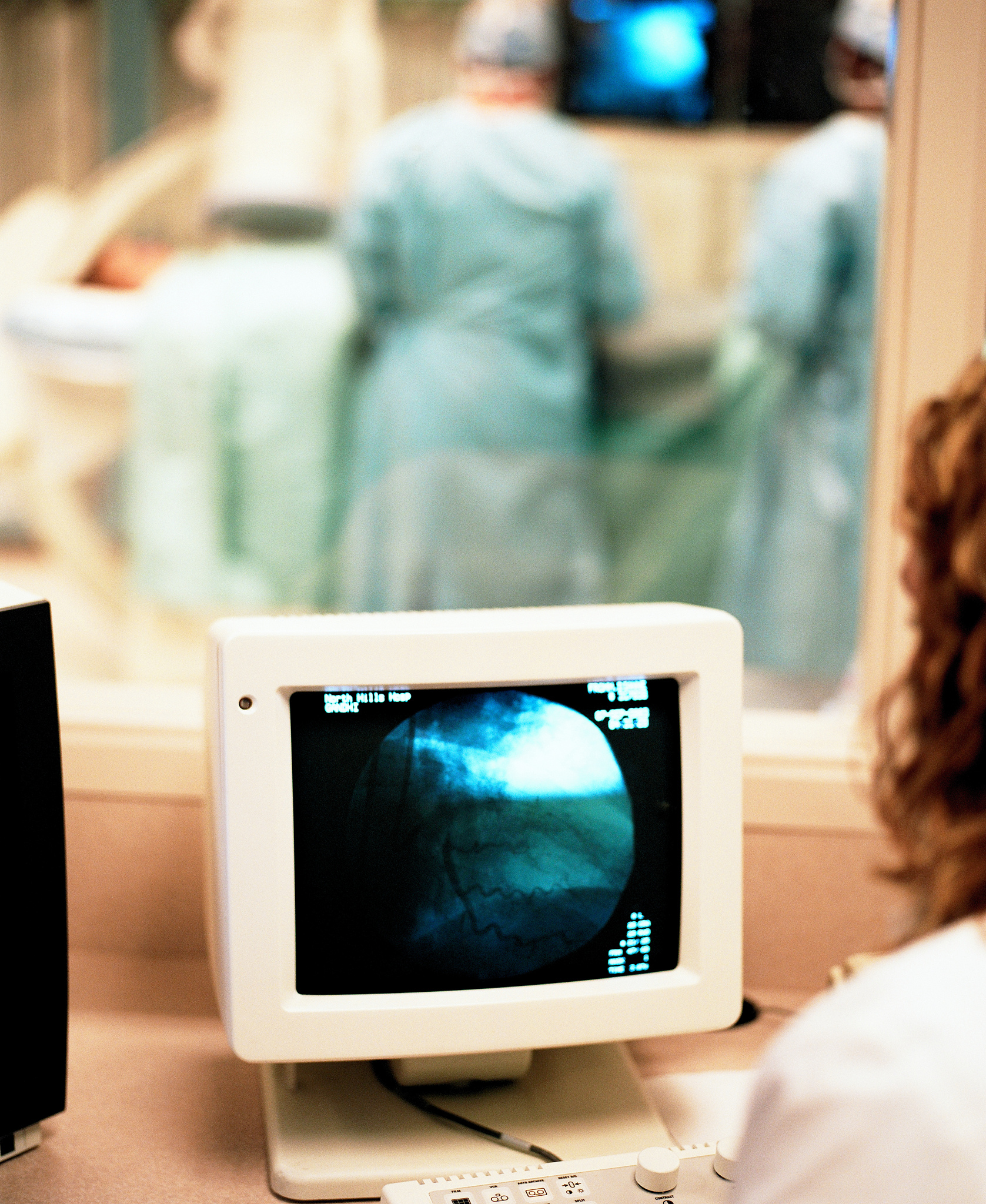 乳腺辅助诊断系统：提高早期诊断率，助力乳腺健康