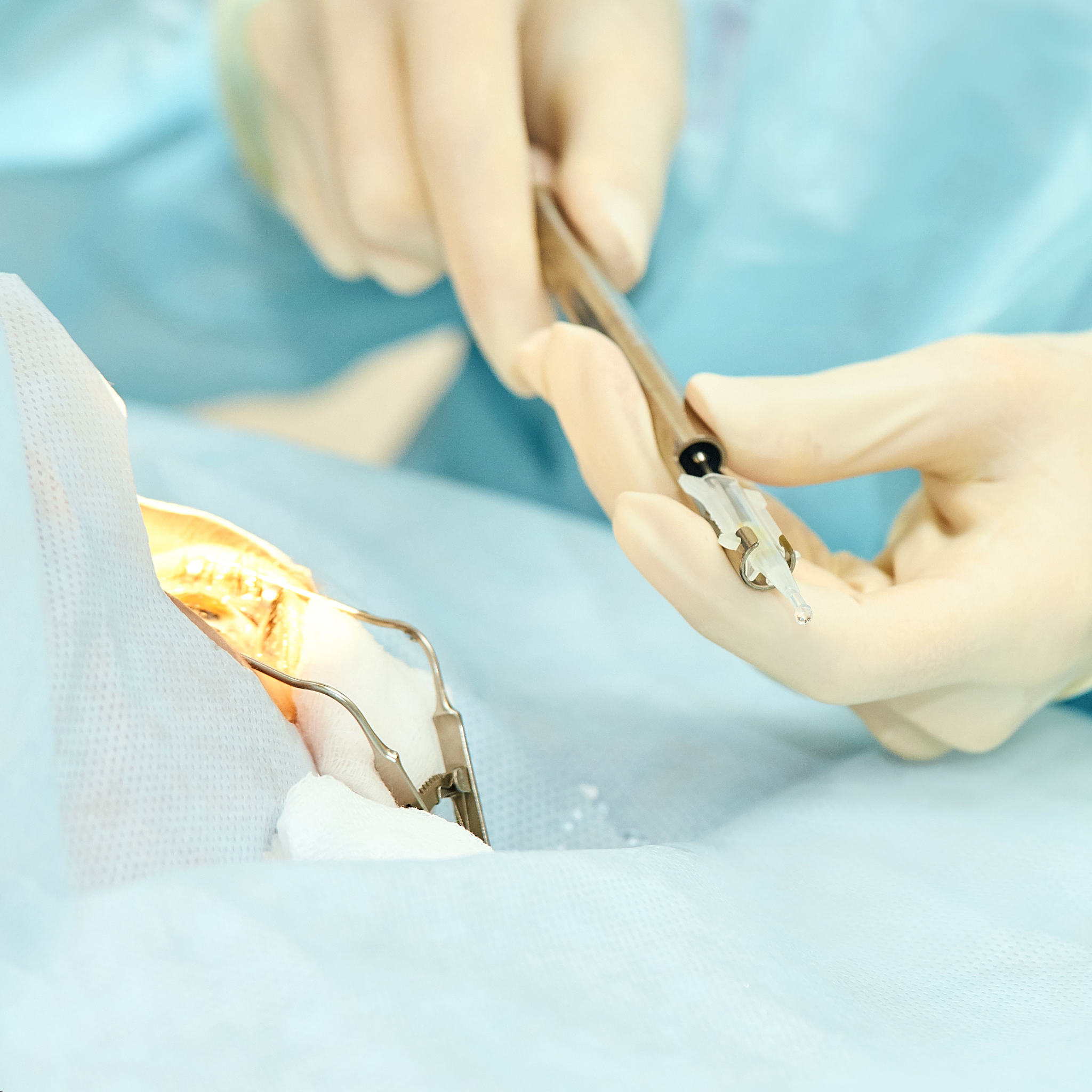 鼎鑫沙棘OPC片适用人群：增强免疫力、抗氧化、保护健康