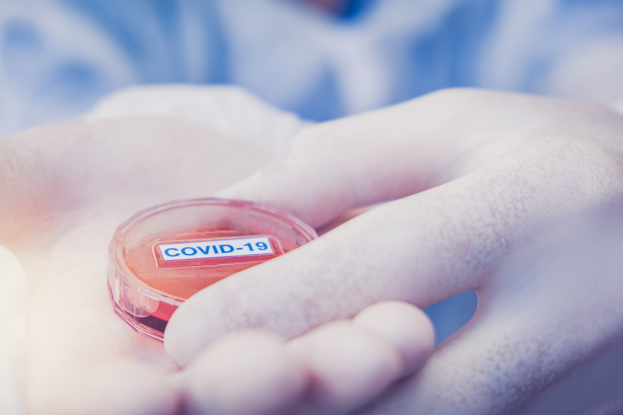 researcher holds test sample with coronavirus virus for analysis