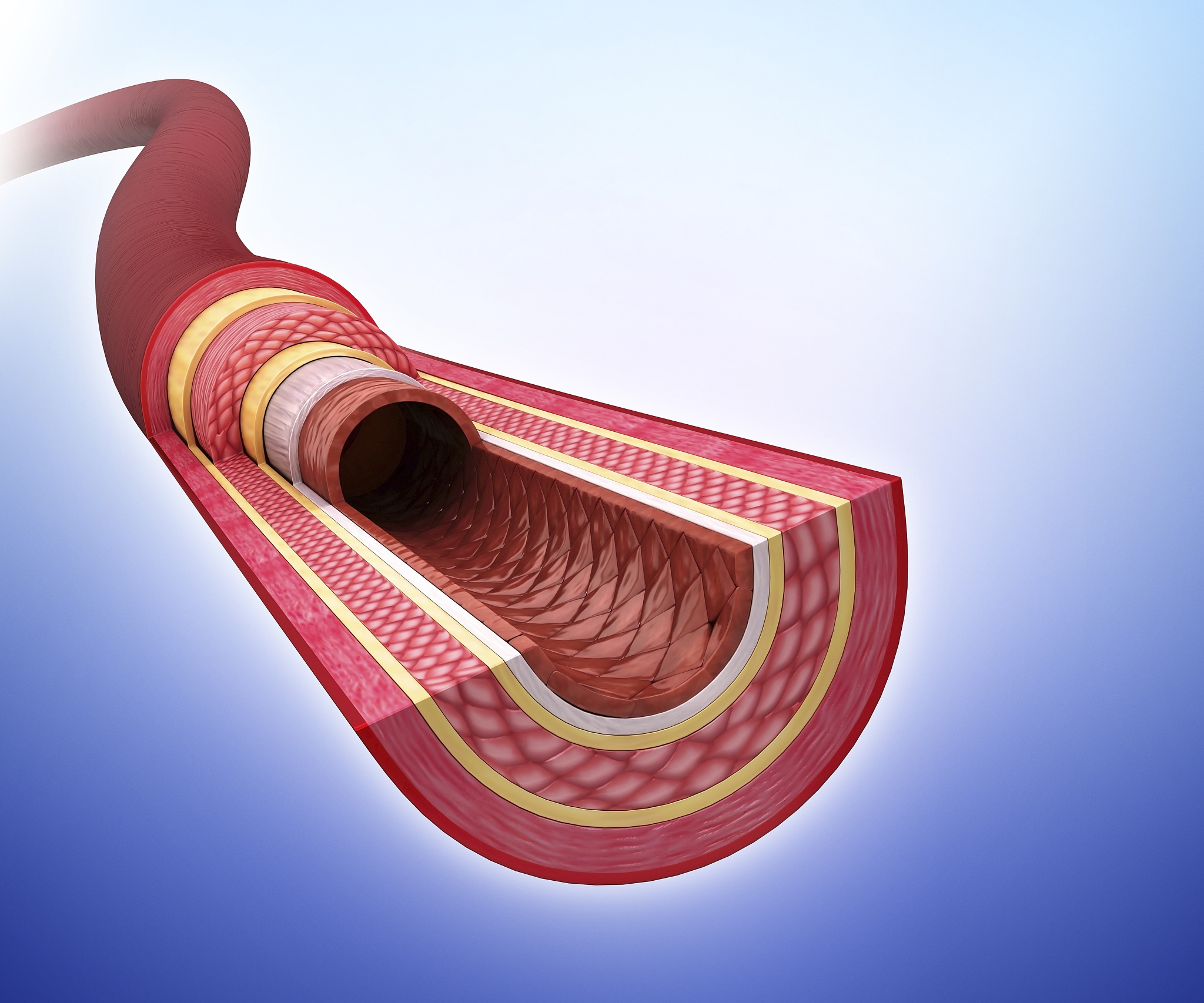 PTA治疗维持性血液透析患者动静脉内瘘狭窄的护理问题及方案