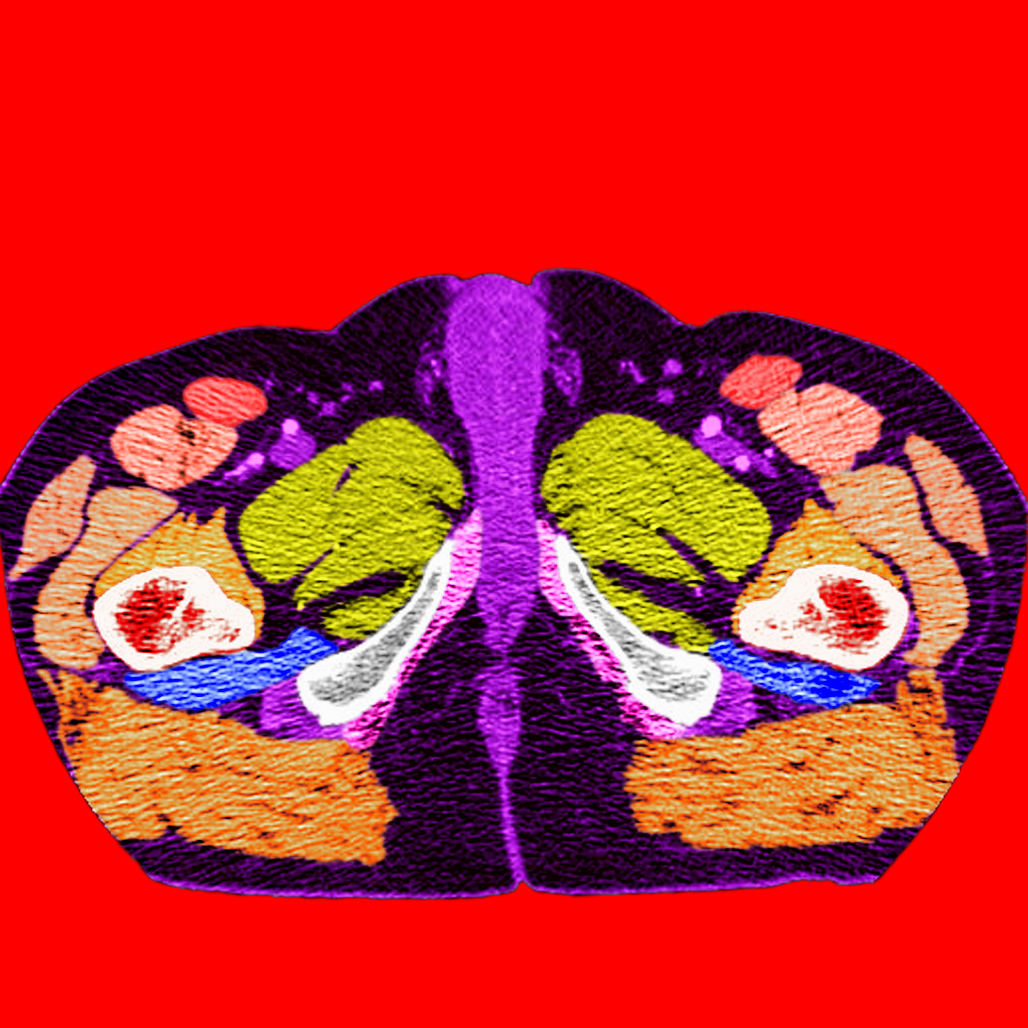 有什么技术可以分类小骨头和大骨头