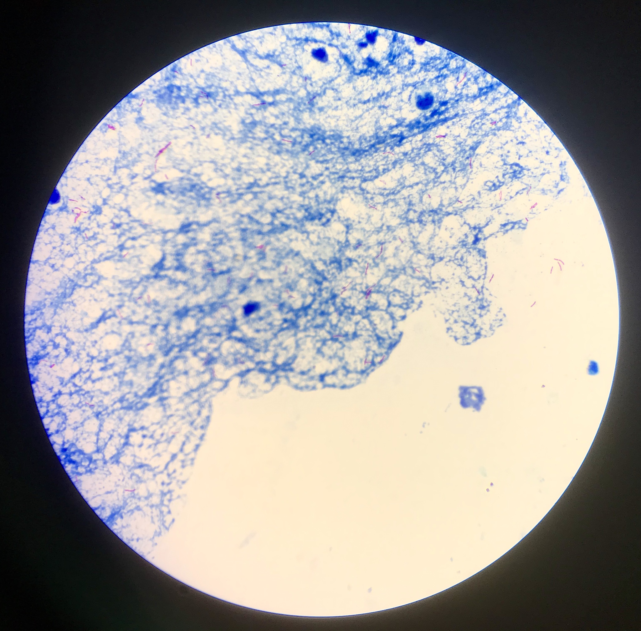 你是一名生物学学者接下来请按我发送给你的格式写实验报告实验报告实验名称：观察植物细胞的结构实验目的：了解植物细胞的结构及其功能。实验原理：植物细胞是由细胞壁、细胞膜、质膜、质网、线粒体、叶绿体、高尔基体、核糖体、核仁和细胞核等组成的。本实验将使用光学显微镜观察植物细胞的结构。实验步骤：1 取一片新鲜的植物叶片用刀片切成薄片。2 将切好的植物叶片放入显微镜载玻片上。3 在载玻片上滴上一滴甘油使植物细