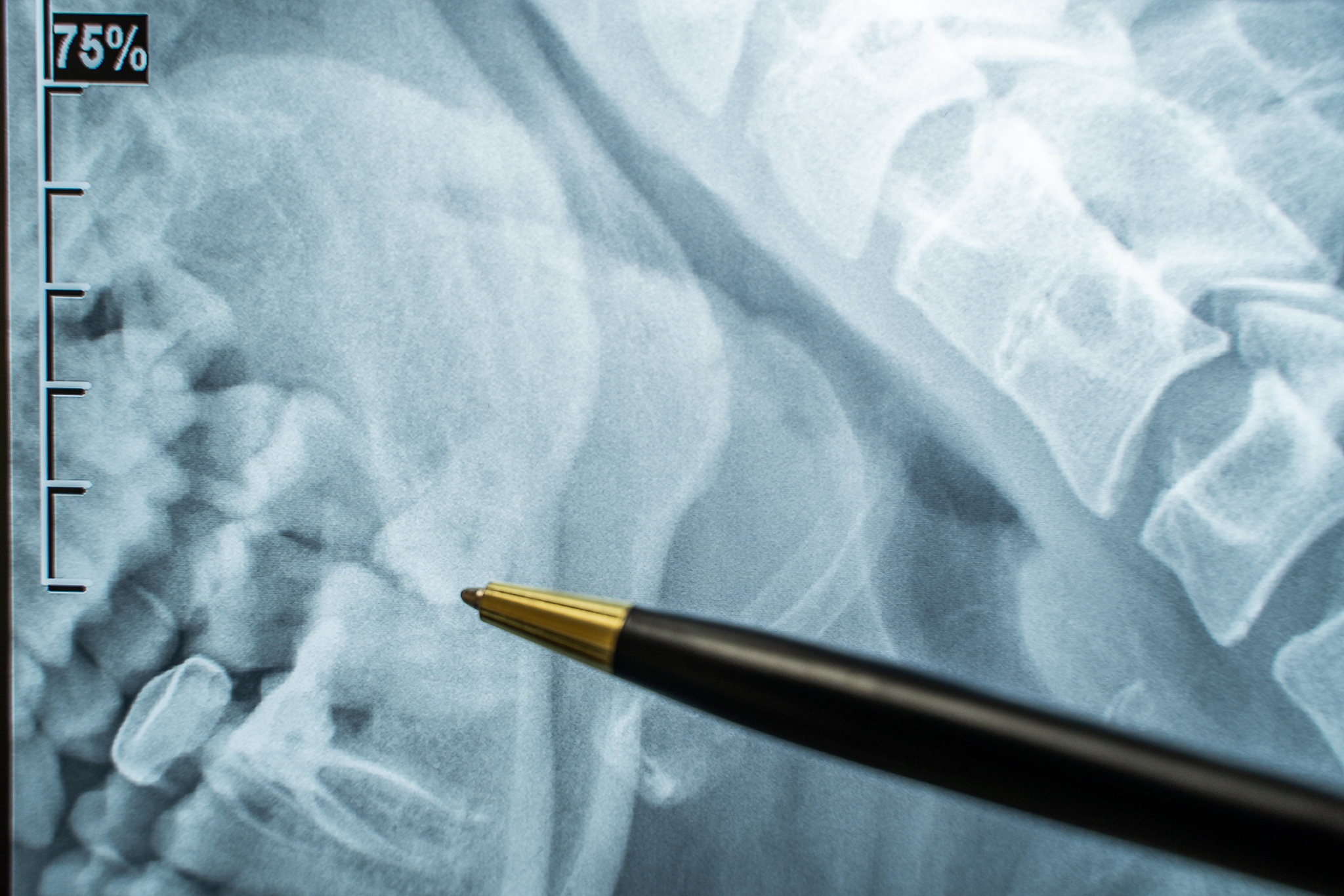 四川2020年招收医学影像专业的卫生学校哪些比较好