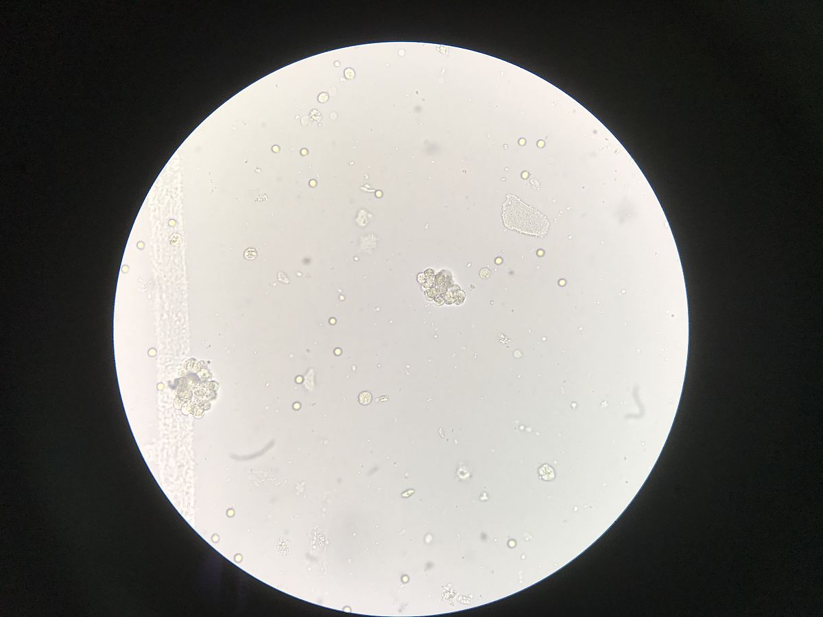 尿素货物结块现象分析及处理建议