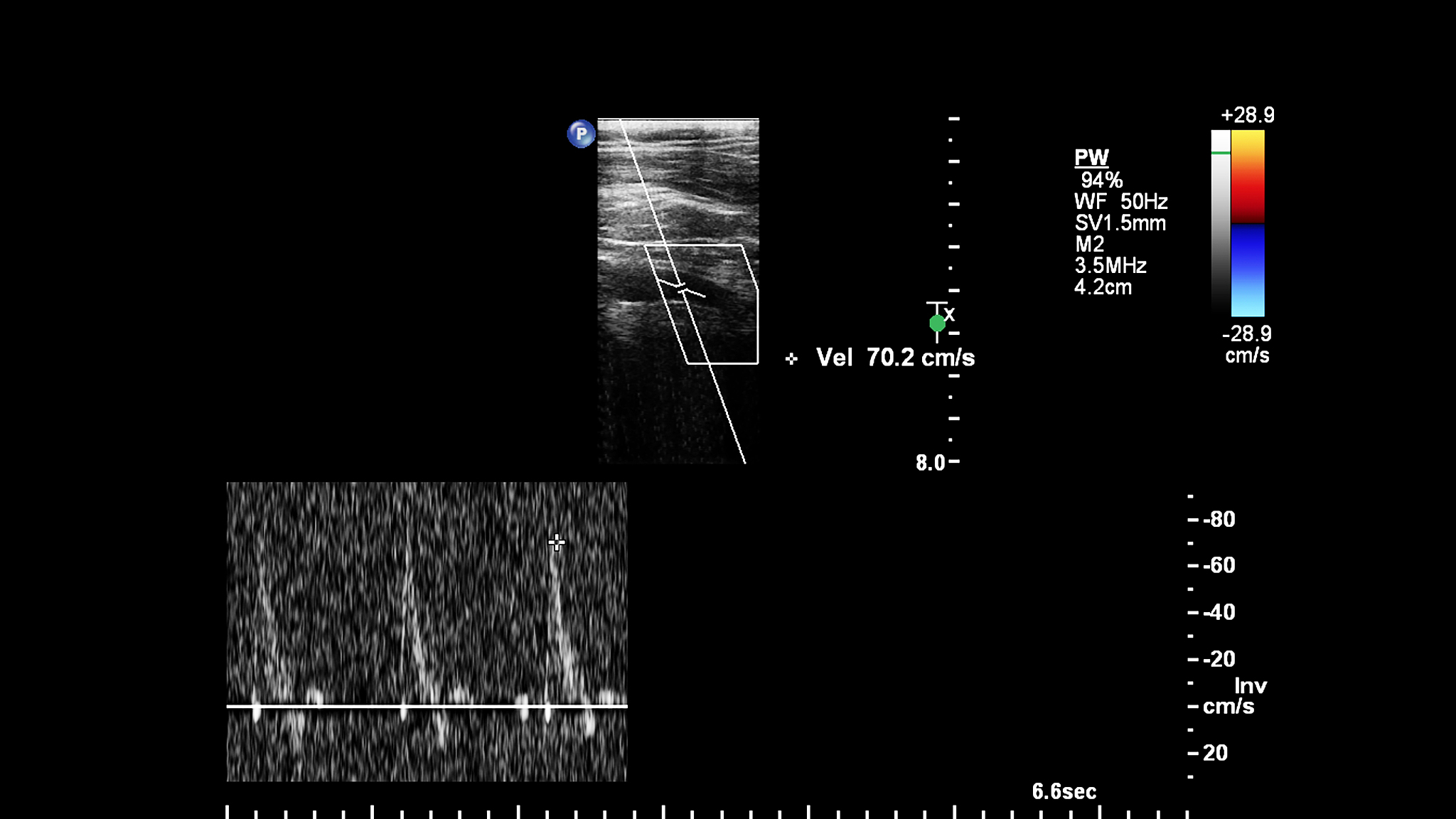 视网膜电位变化：杆状细胞外段电流的细胞外流动