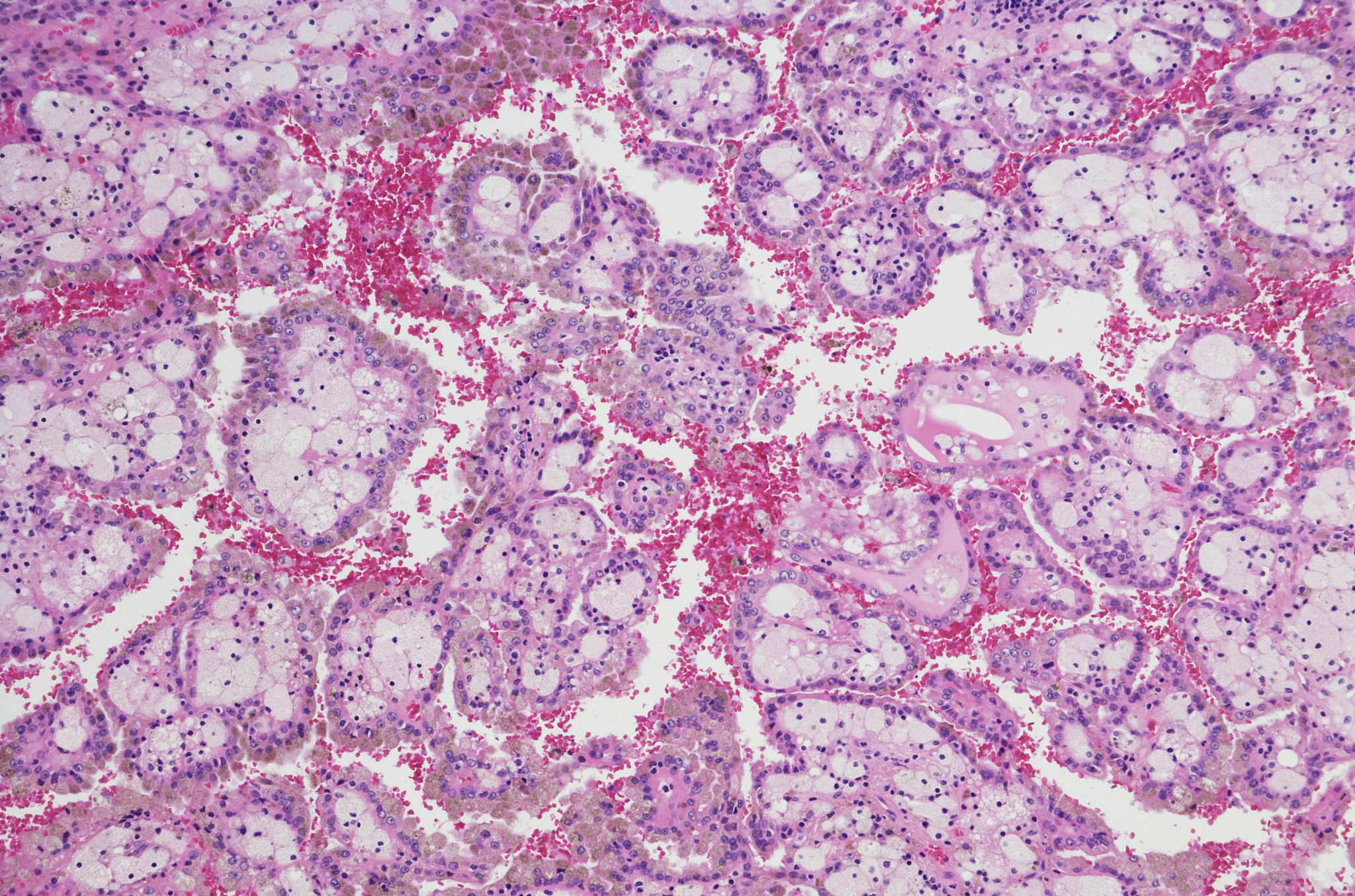 水的等渗性重吸收发生在哪里回答及拓展