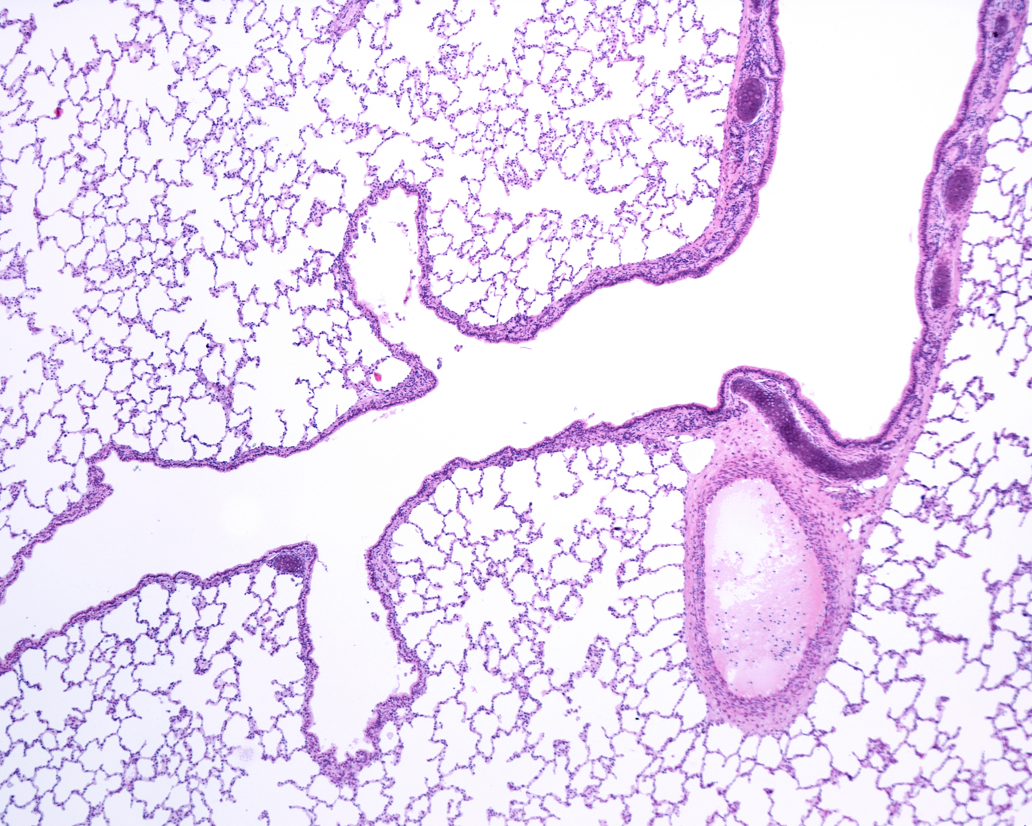 bronchus and bronchioles
