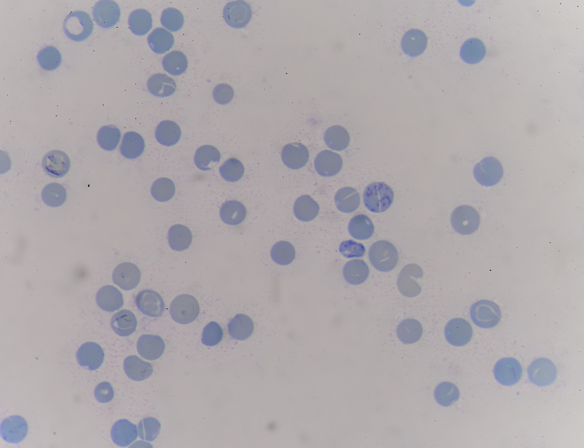 血小板在慢性肝炎中的作用