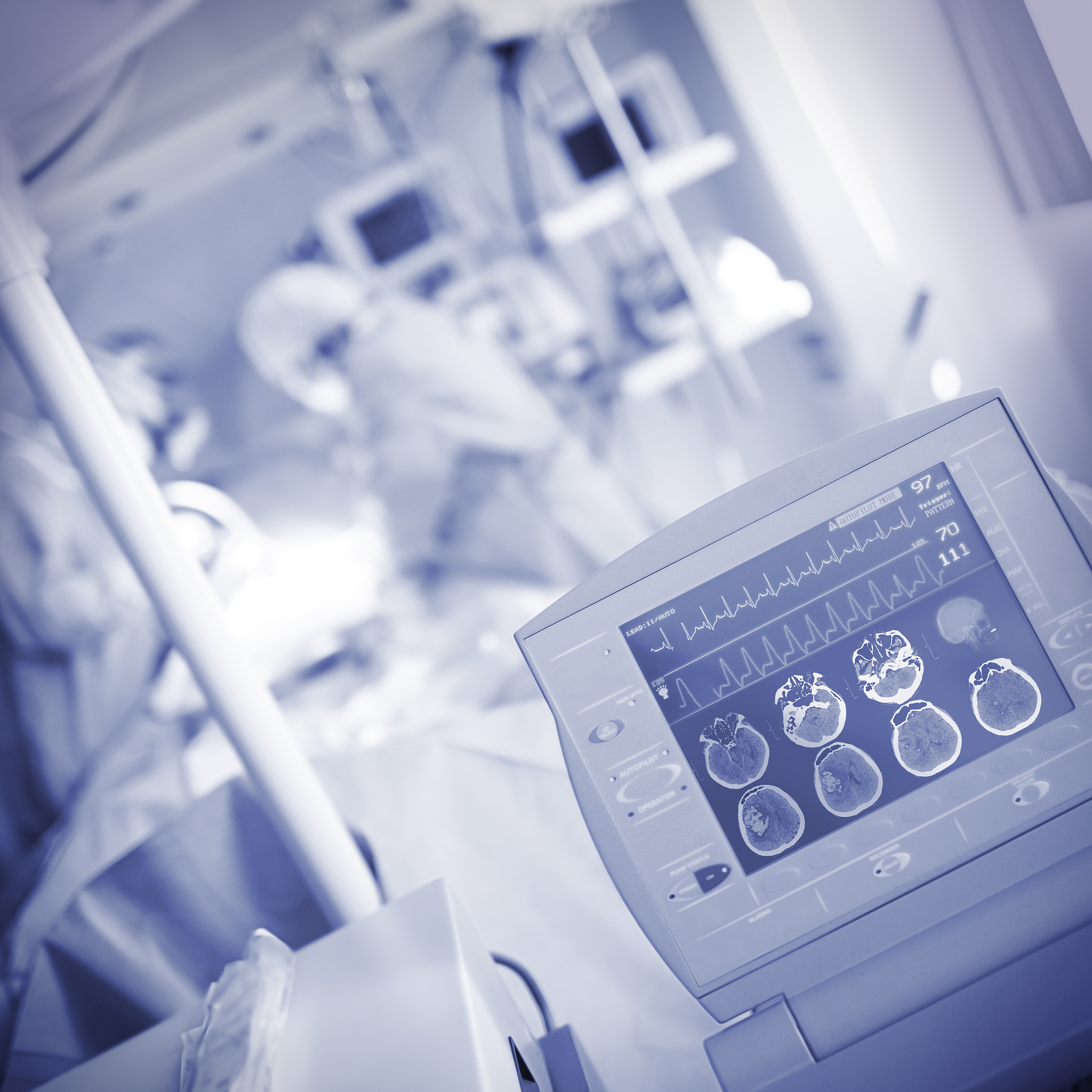 神经外科实习生最后一周周记：手术室、病房、病例讨论会 - 成长与收获