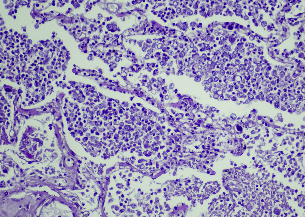 医学影像分析中的潜在错误：以CEUS、CTA和DSA为例