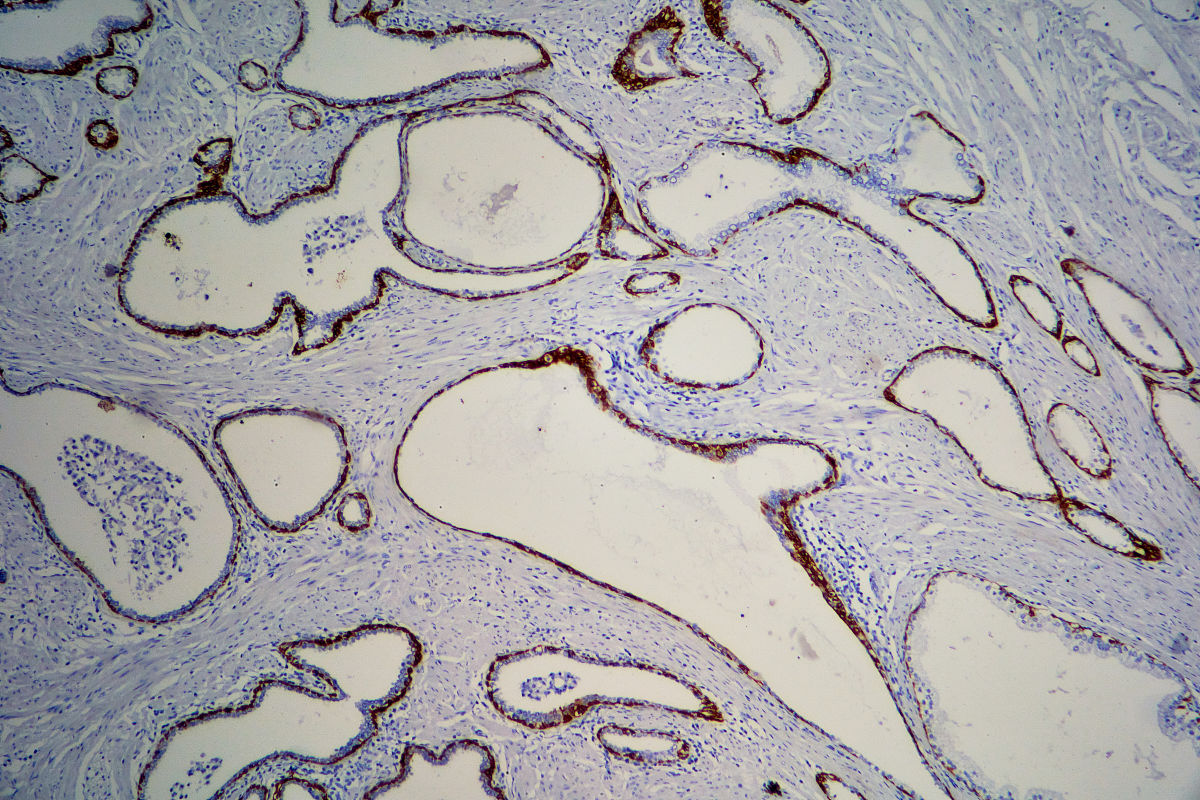 石蜡切片法中脱水后将直接样品放入加热的石蜡中使其充分浸透。