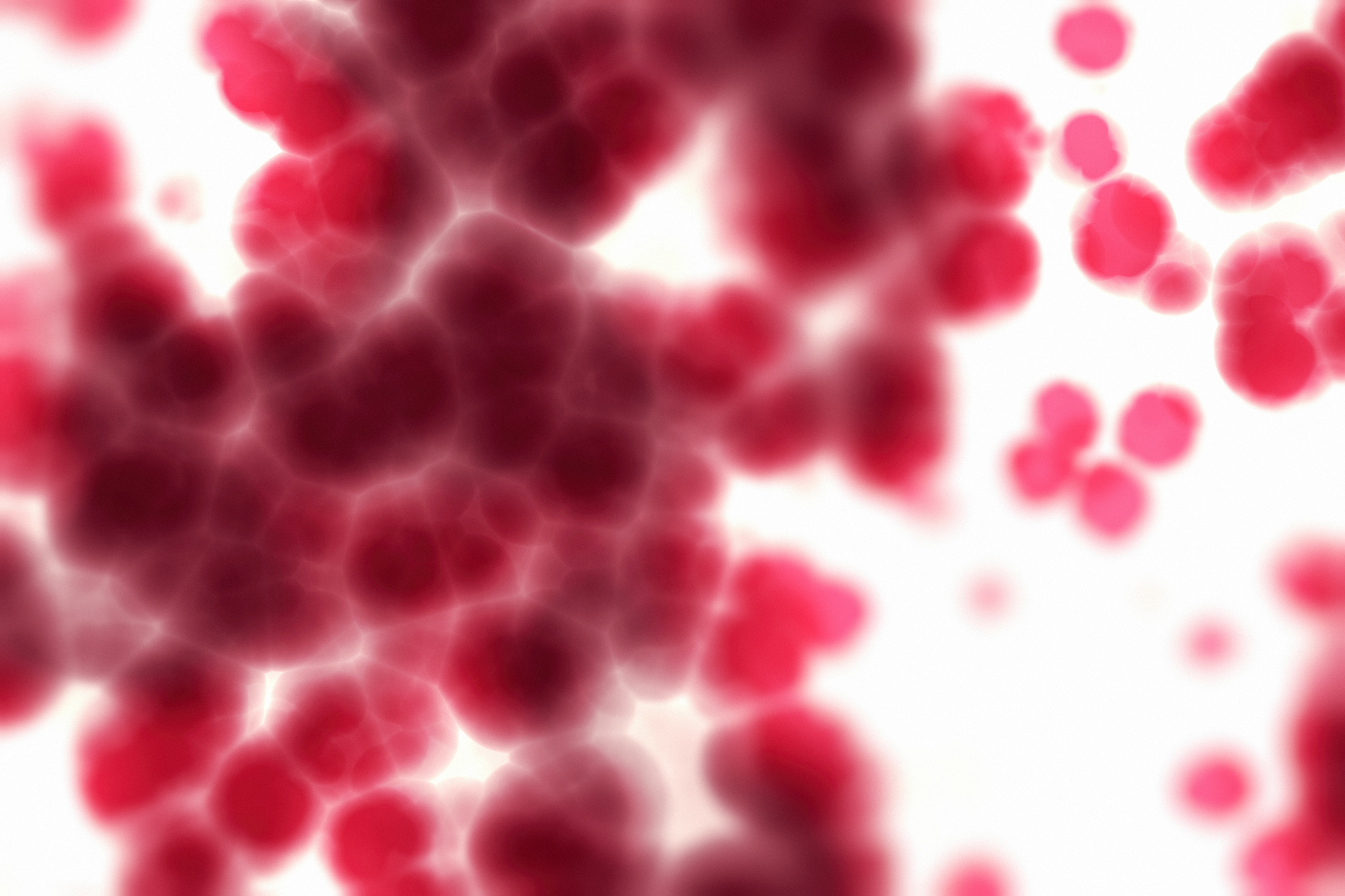 医学检验中血液细胞检验的质量控制影响因素