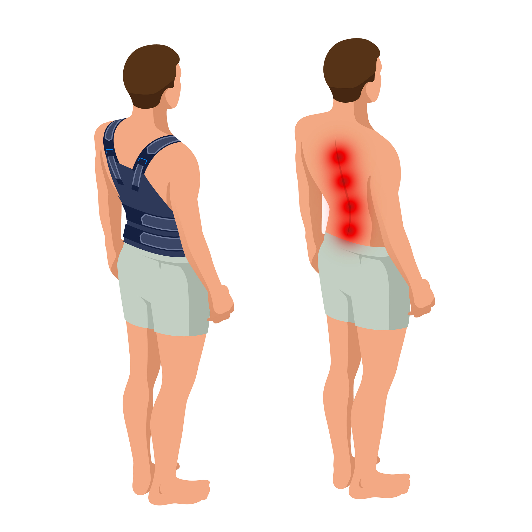腰痛类型及鉴别：寒湿腰痛、湿热腰痛、瘀血腰痛