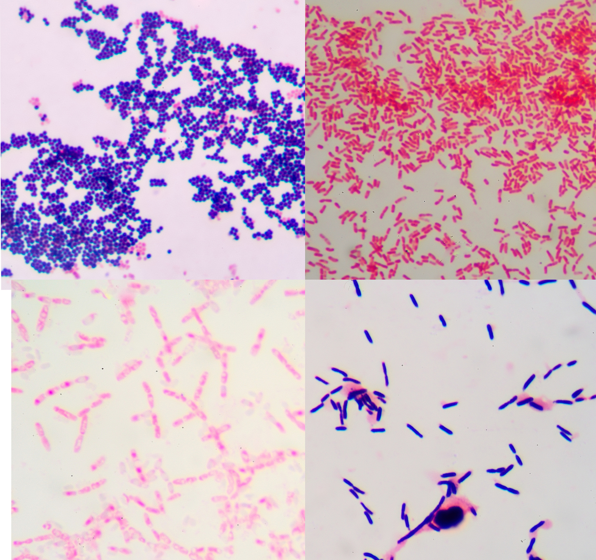 Masson 染色法：病理学研究的利器
