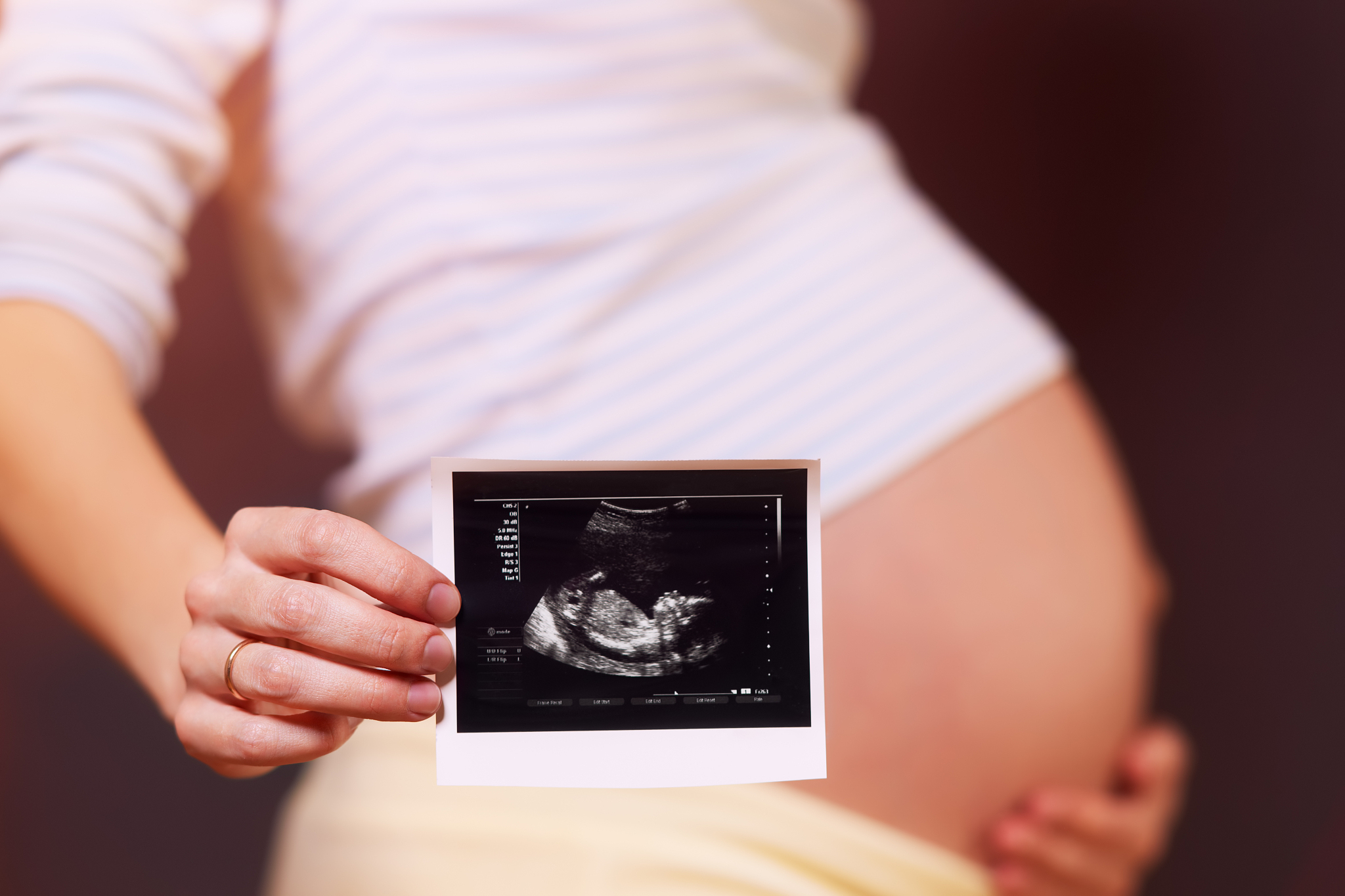 pregnant woman