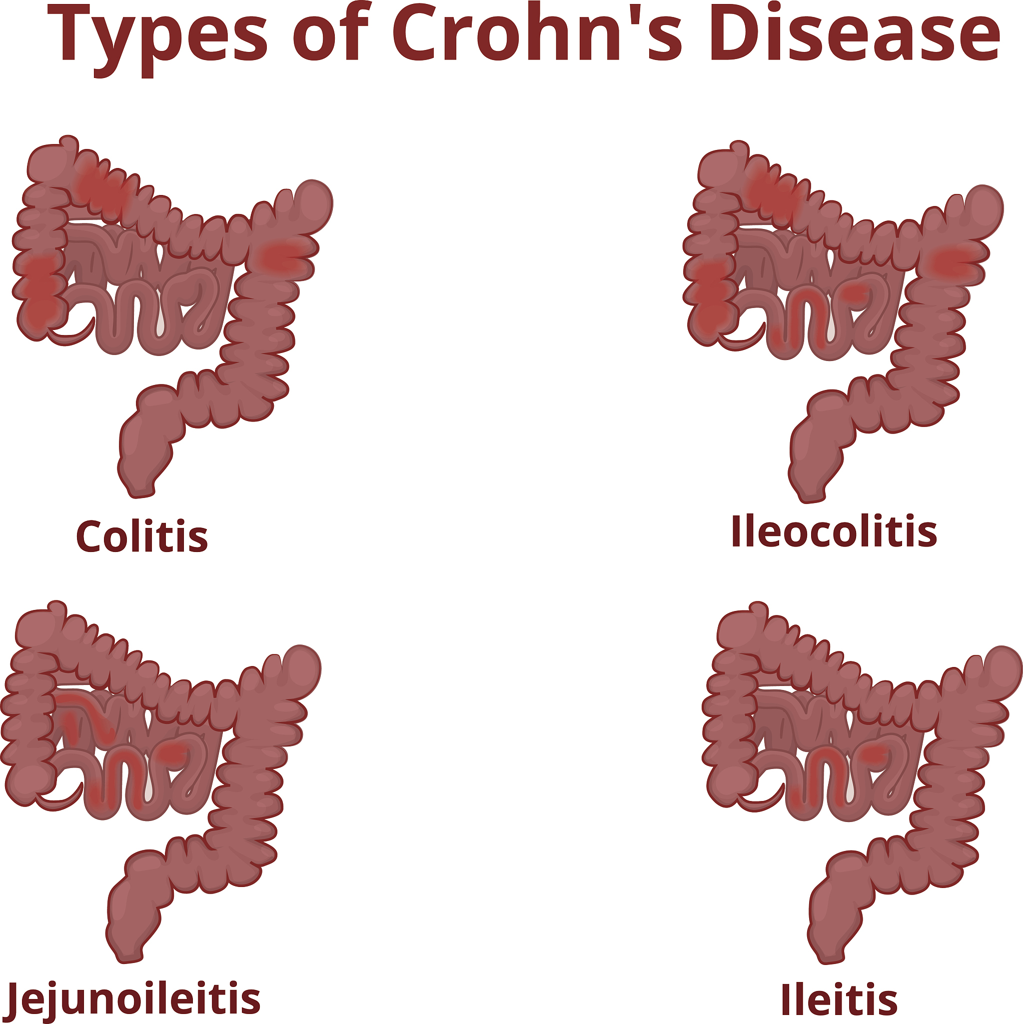 利巴韦林在肠道病毒怎么作用的