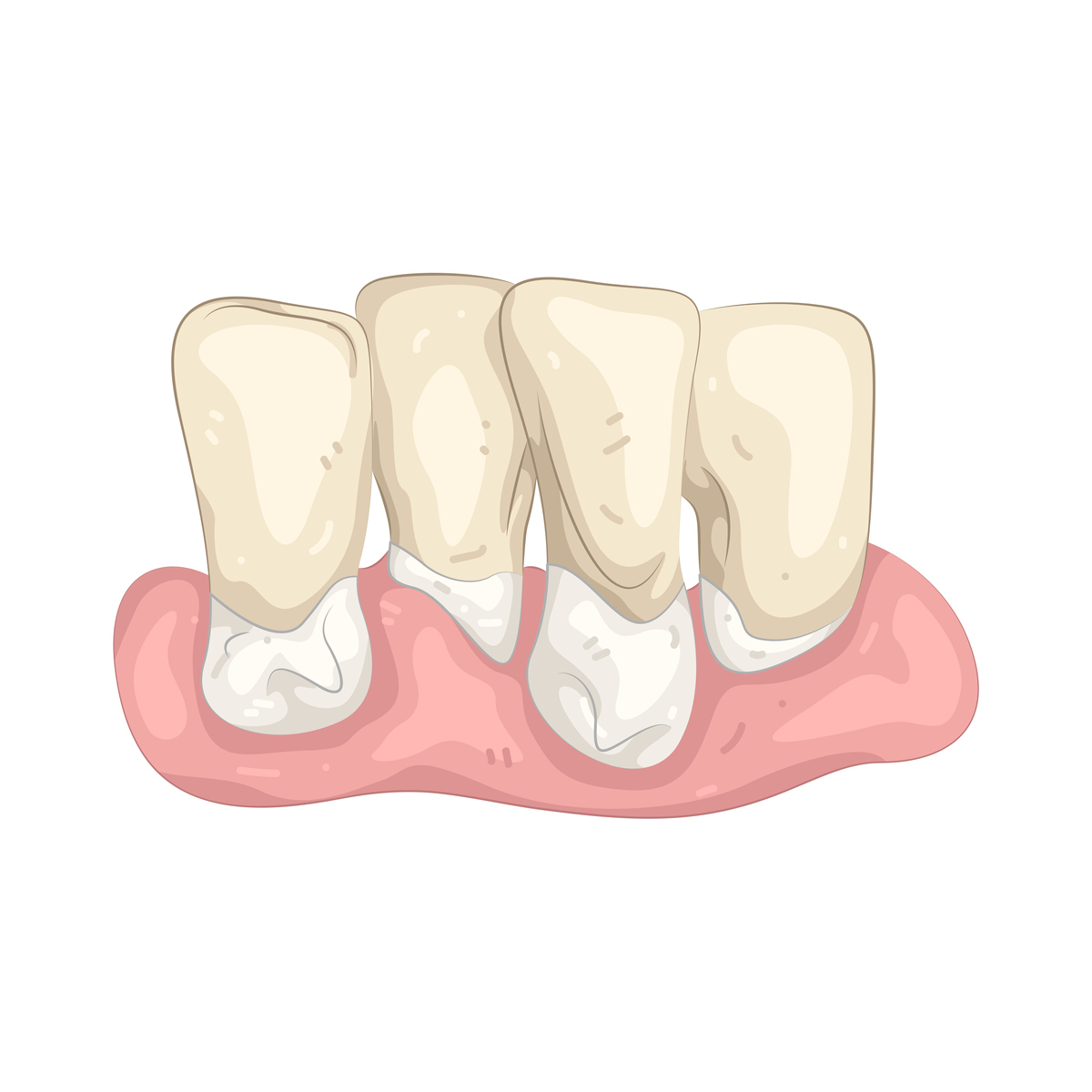 试以乳中切牙为例描述牙齿发育的全过程