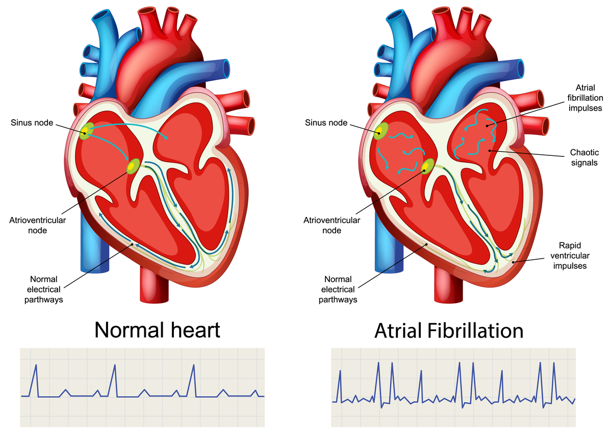 心脏壁最外层：心膜及其重要作用
