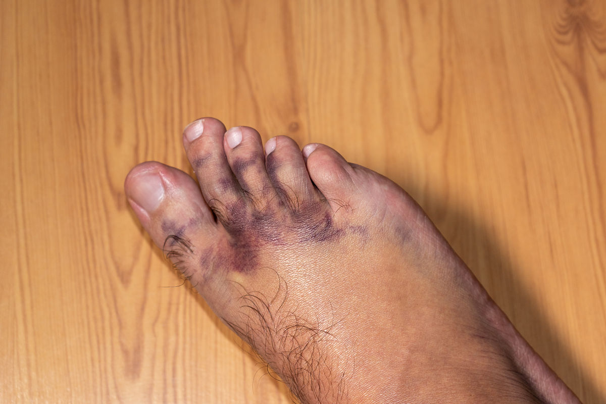 脚踝疼还眼冒金星