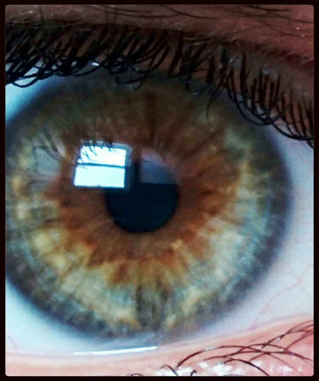 犬多发性视网膜病变临床表现