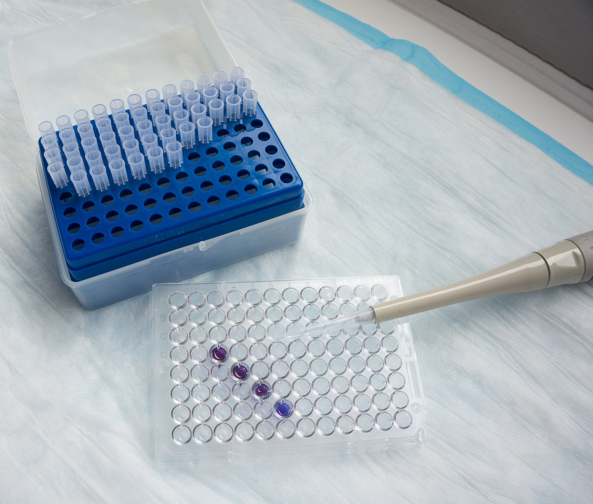 初中毕业读医学检验专业好不好？