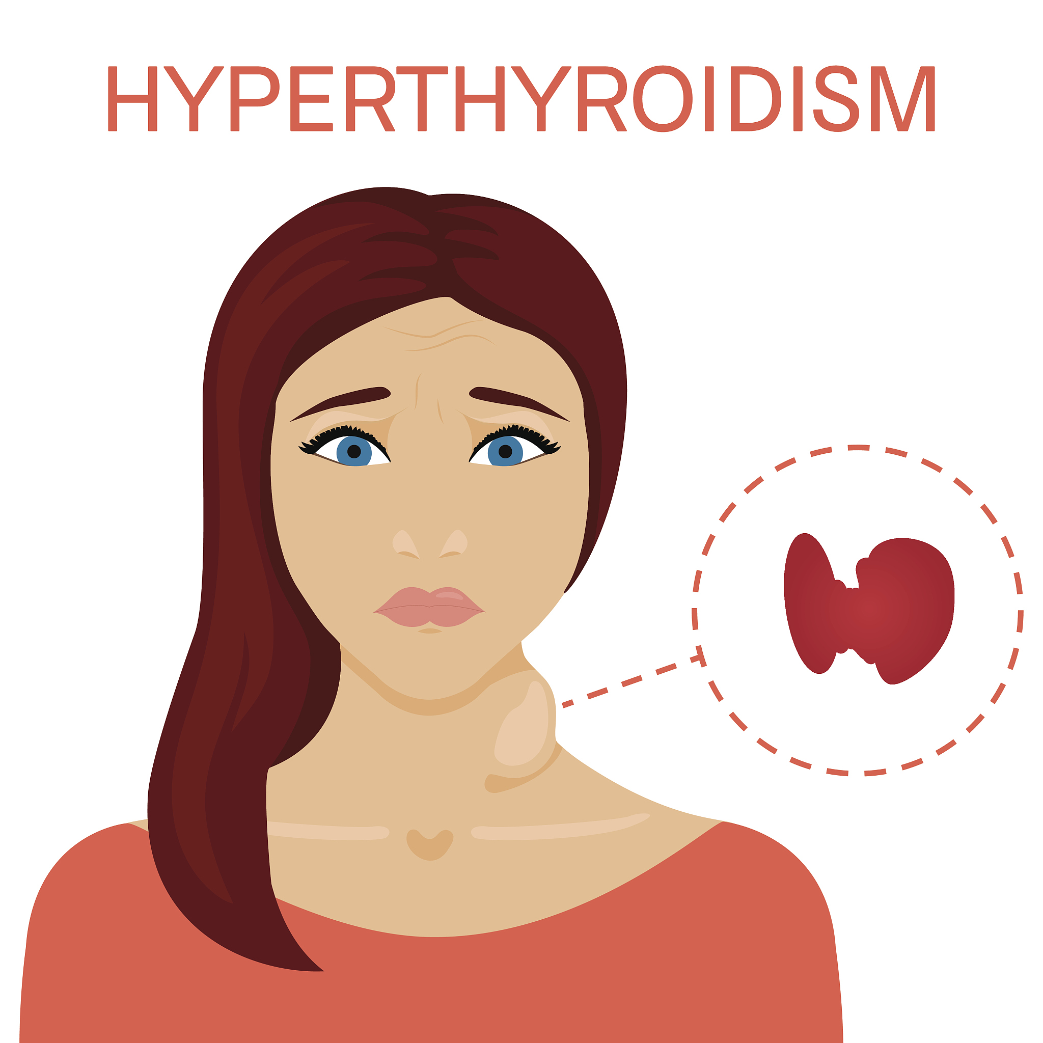 妊娠期甲亢：免疫系统变化的危害和应对