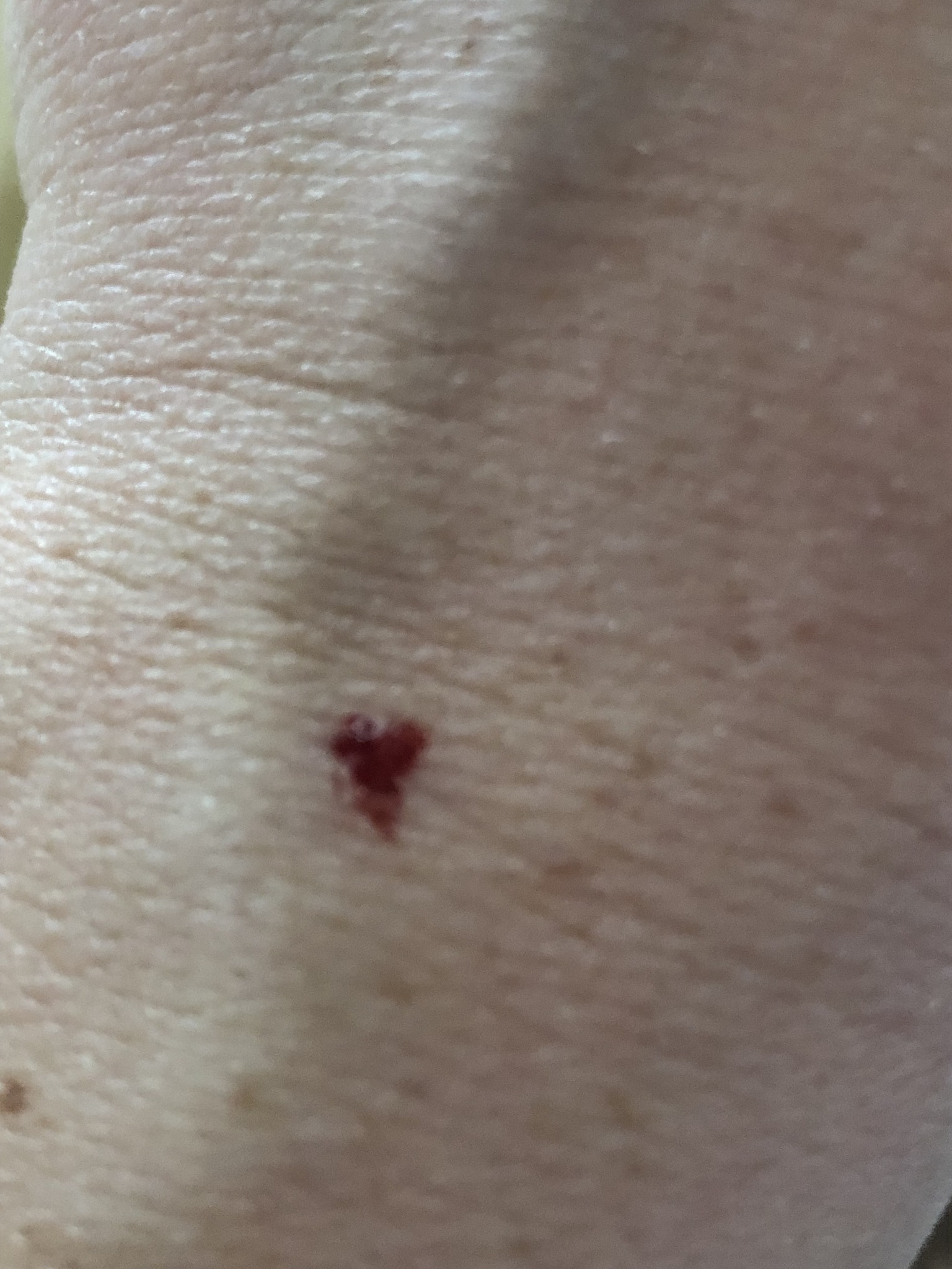 heart