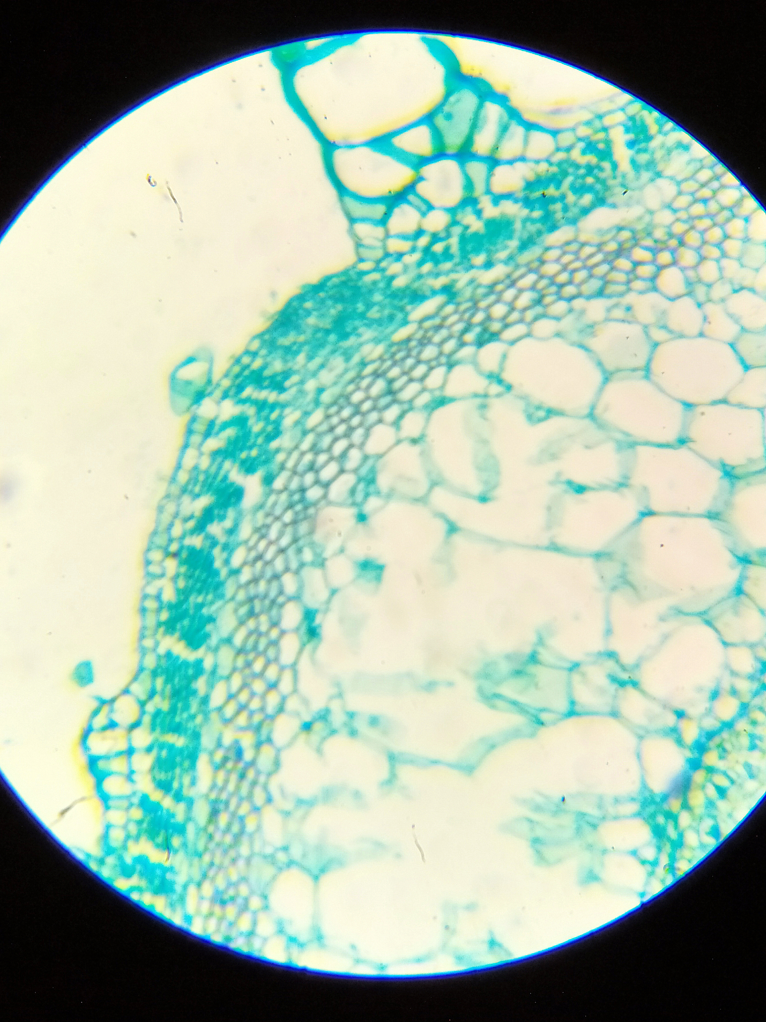 若在制片中仅看到游离芽孢。而很少看到芽胞囊和营养细胞是分析原因。