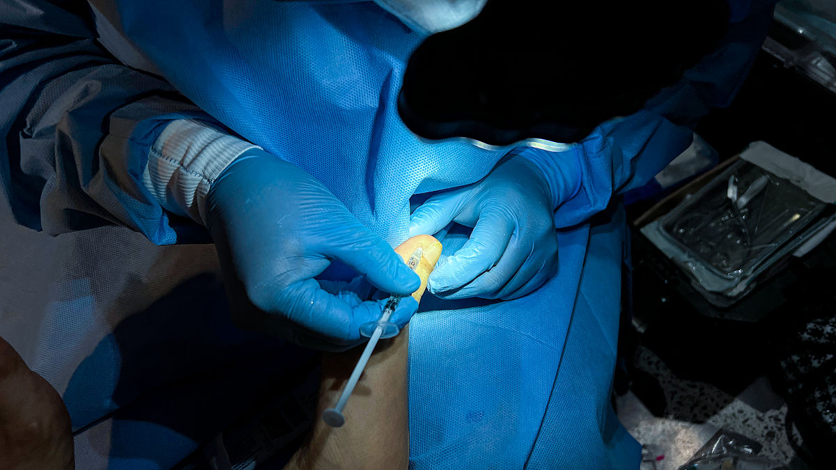 静吸复合麻醉：适用范围及注意事项