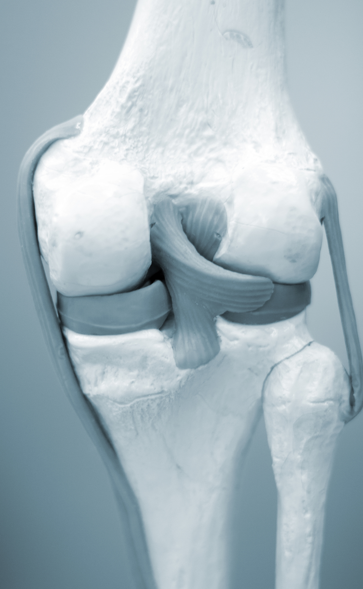 踝关节韧带修复手术方法：解剖重建和非解剖重建