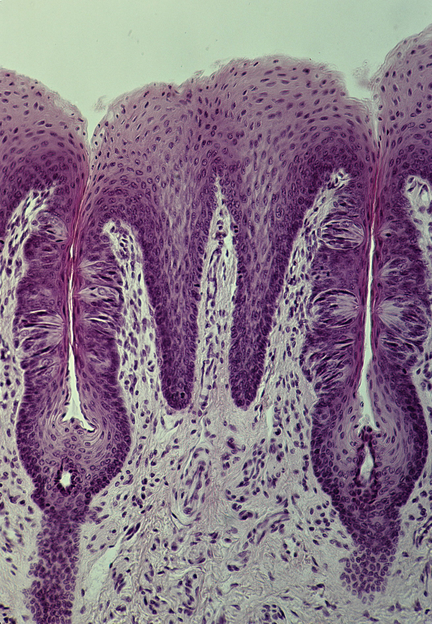 盐为什么是咸的？解密咸味背后的科学原理