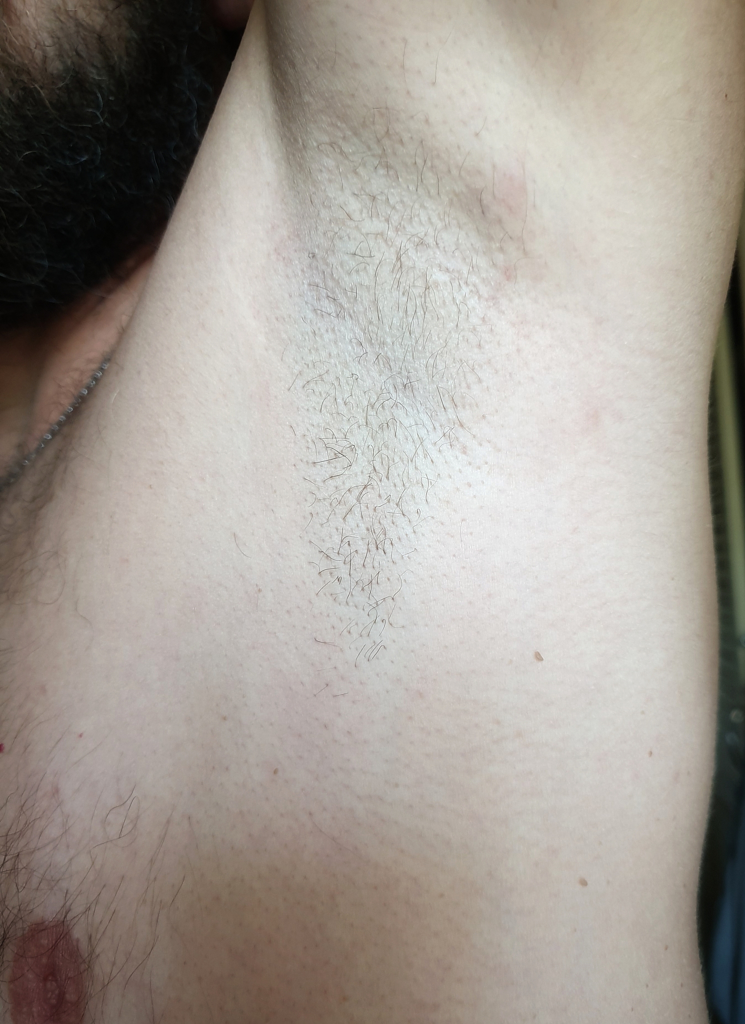 shaving hair under the armpits, growing hair on the body of a ma