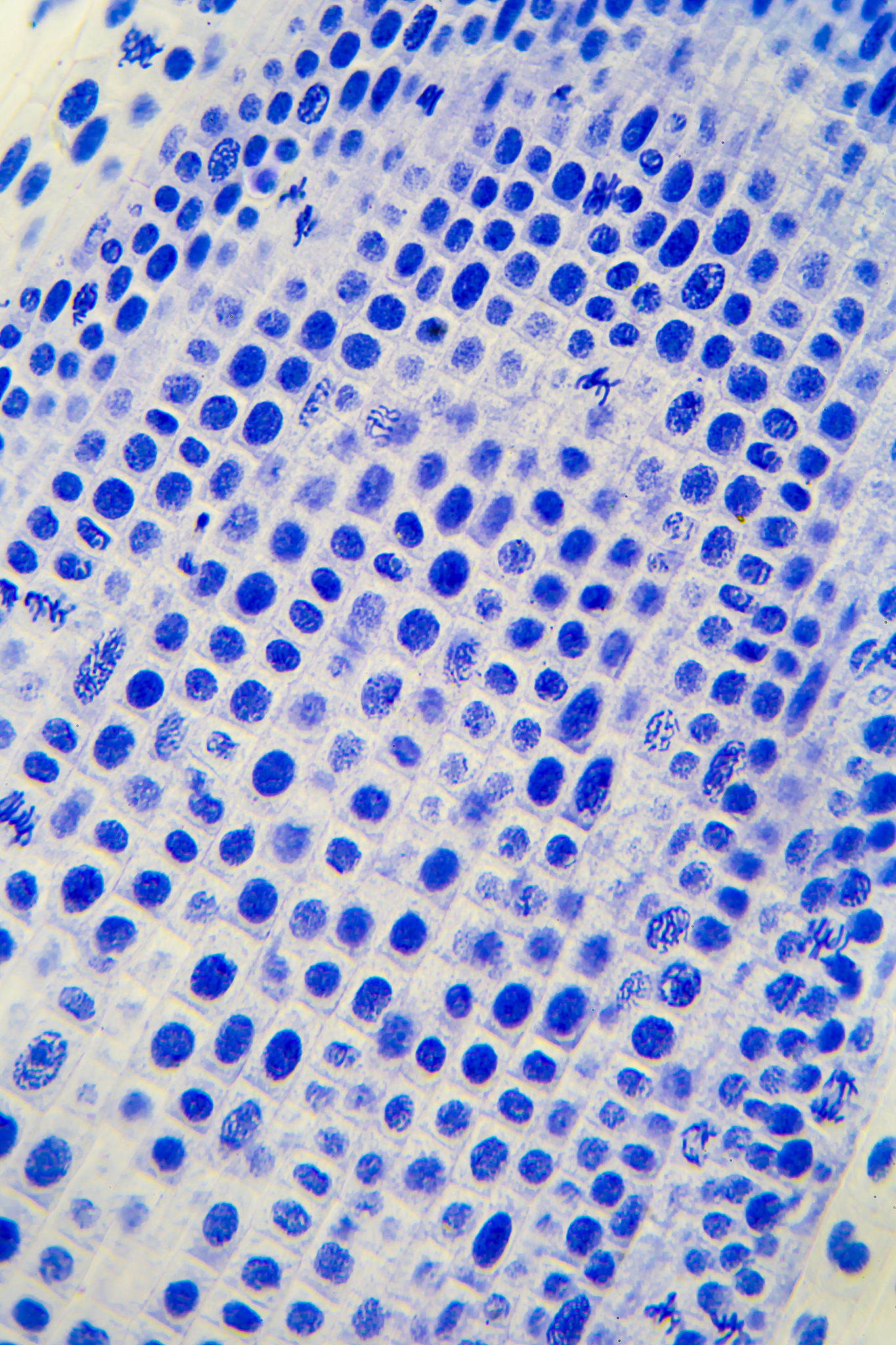 石蜡切片法脱水操作步骤详解 - 耗时及注意事项
