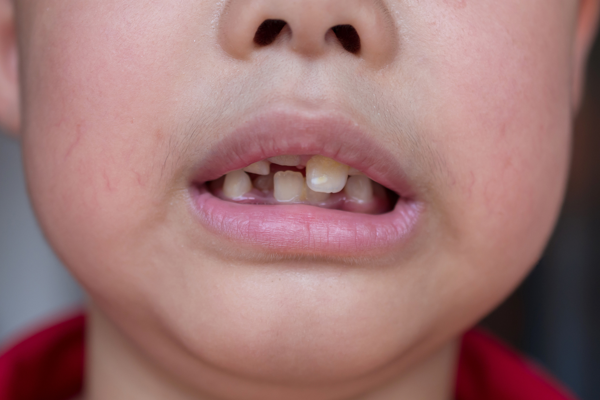 吸烟、碳酸饮料和盐摄入对龋病的影响：科学研究总结