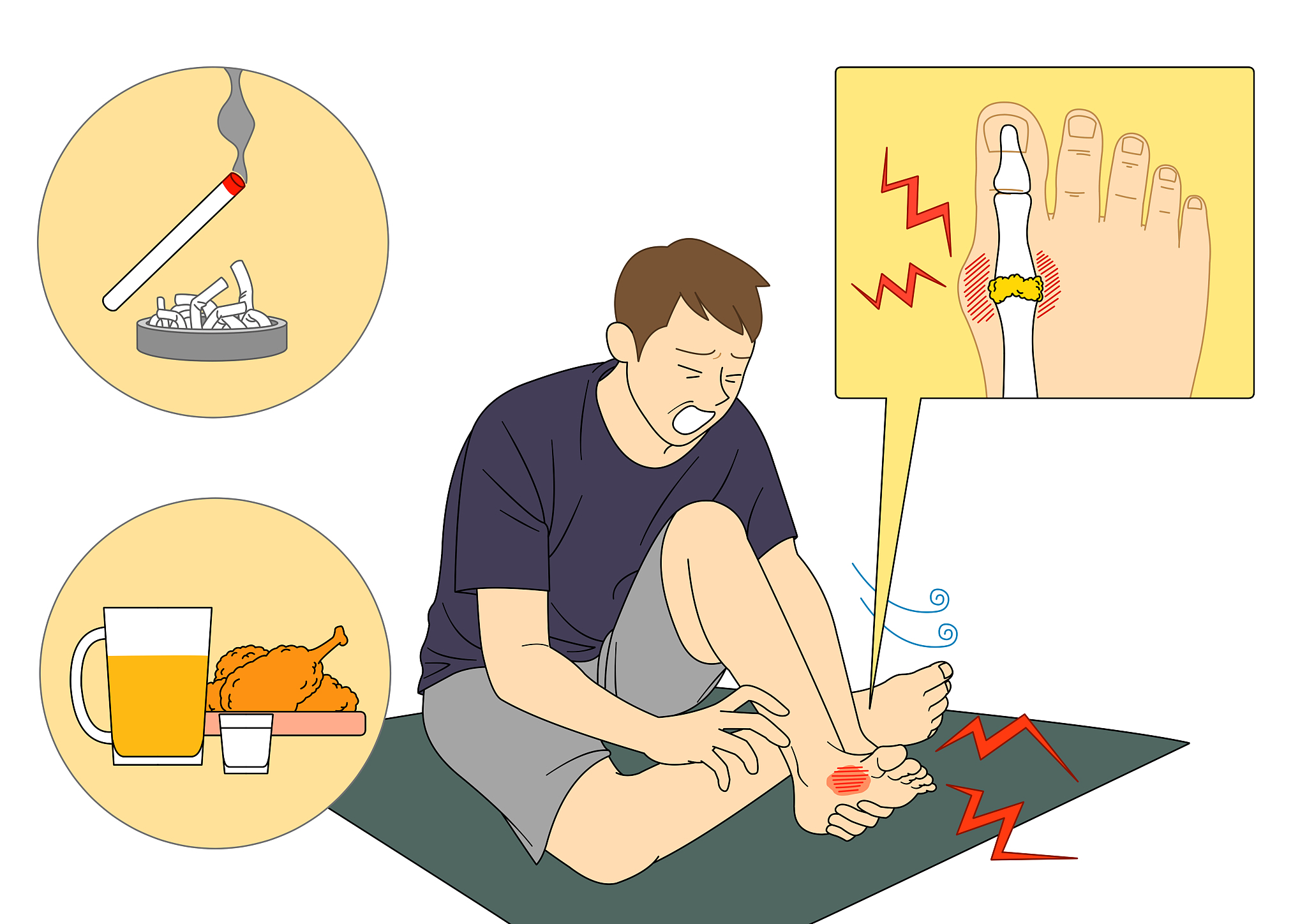肌肉抽筋怎么办？原因分析及应对方法