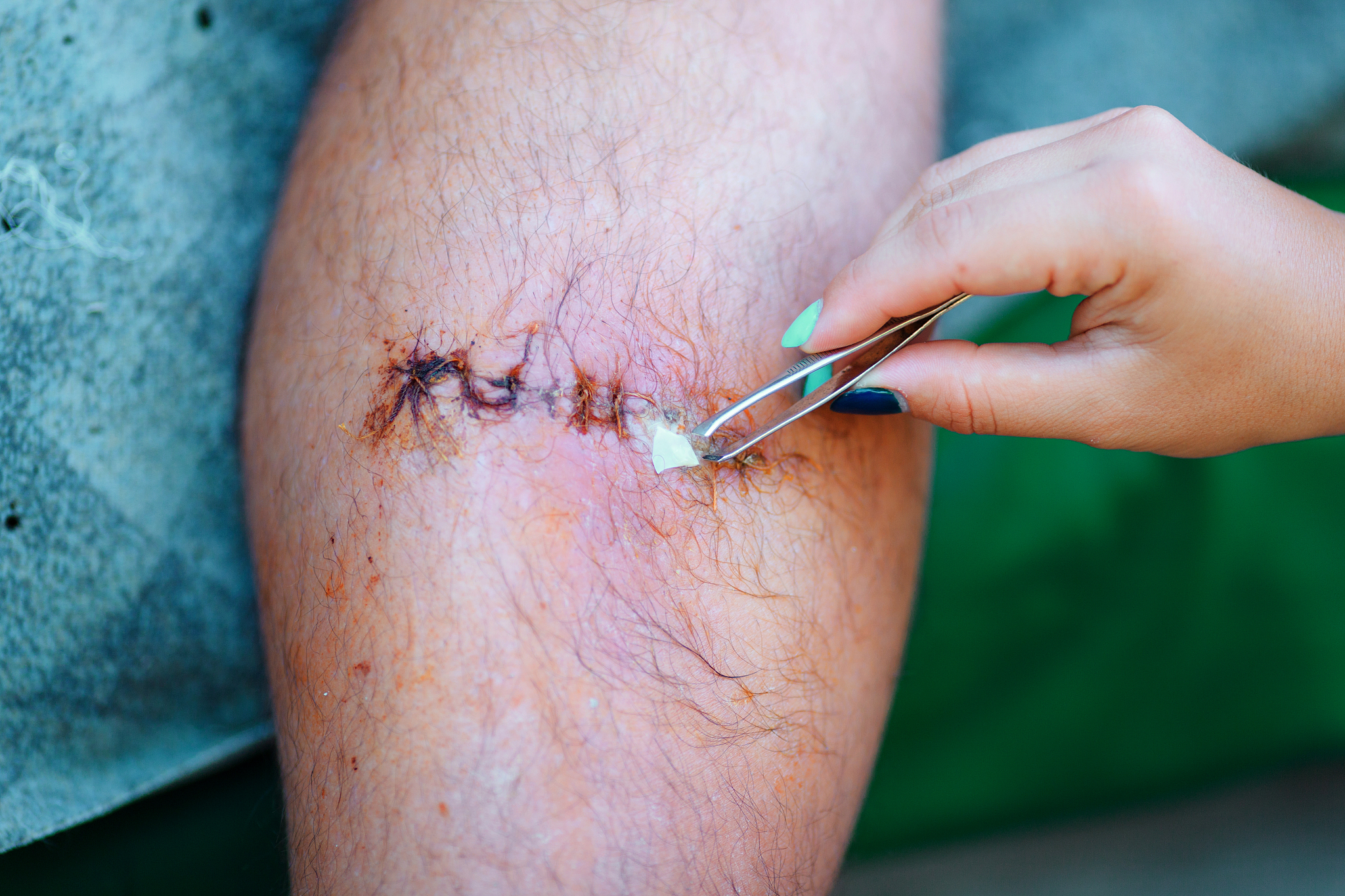 过氧化氢：水产养殖的化学增氧剂