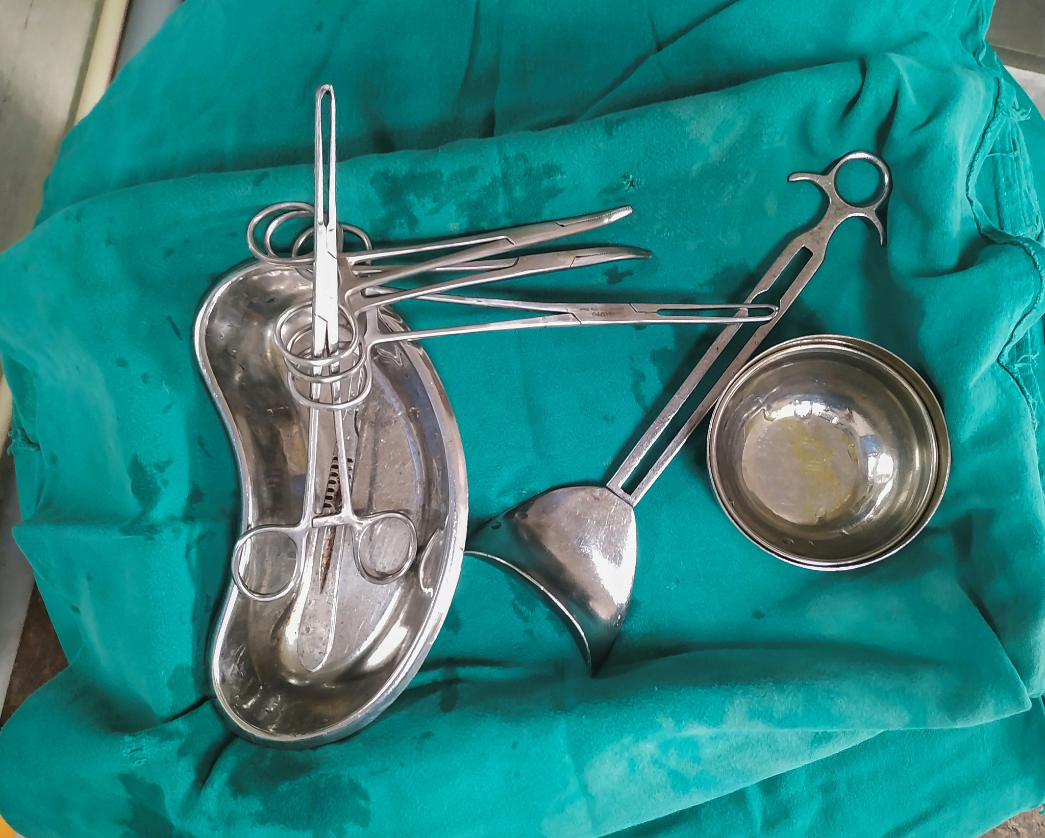 腹腔镜阑尾切除术器具动态检测与技能量化评价研究的难点