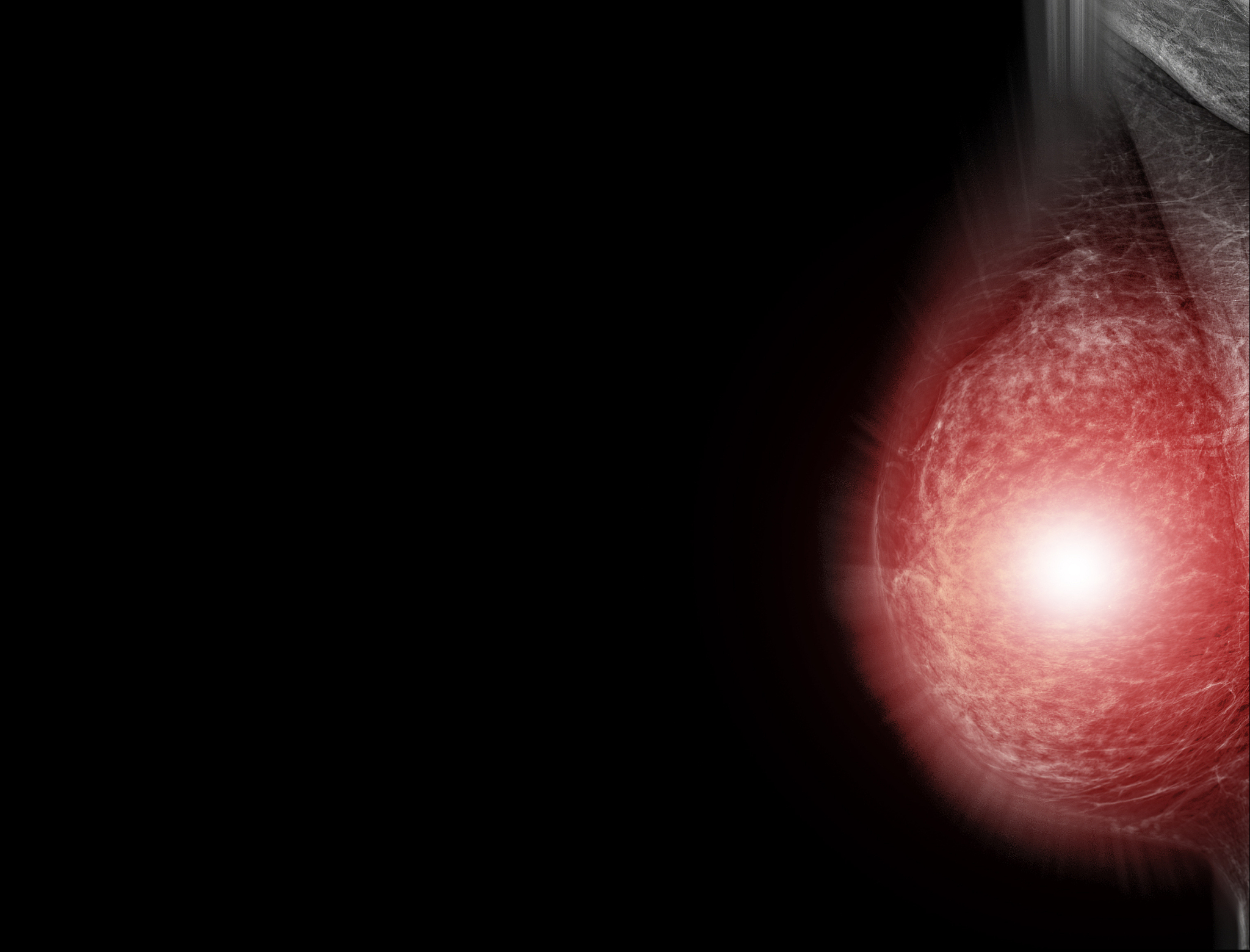 MLO View Mammogram: What It Is and Why It's Important